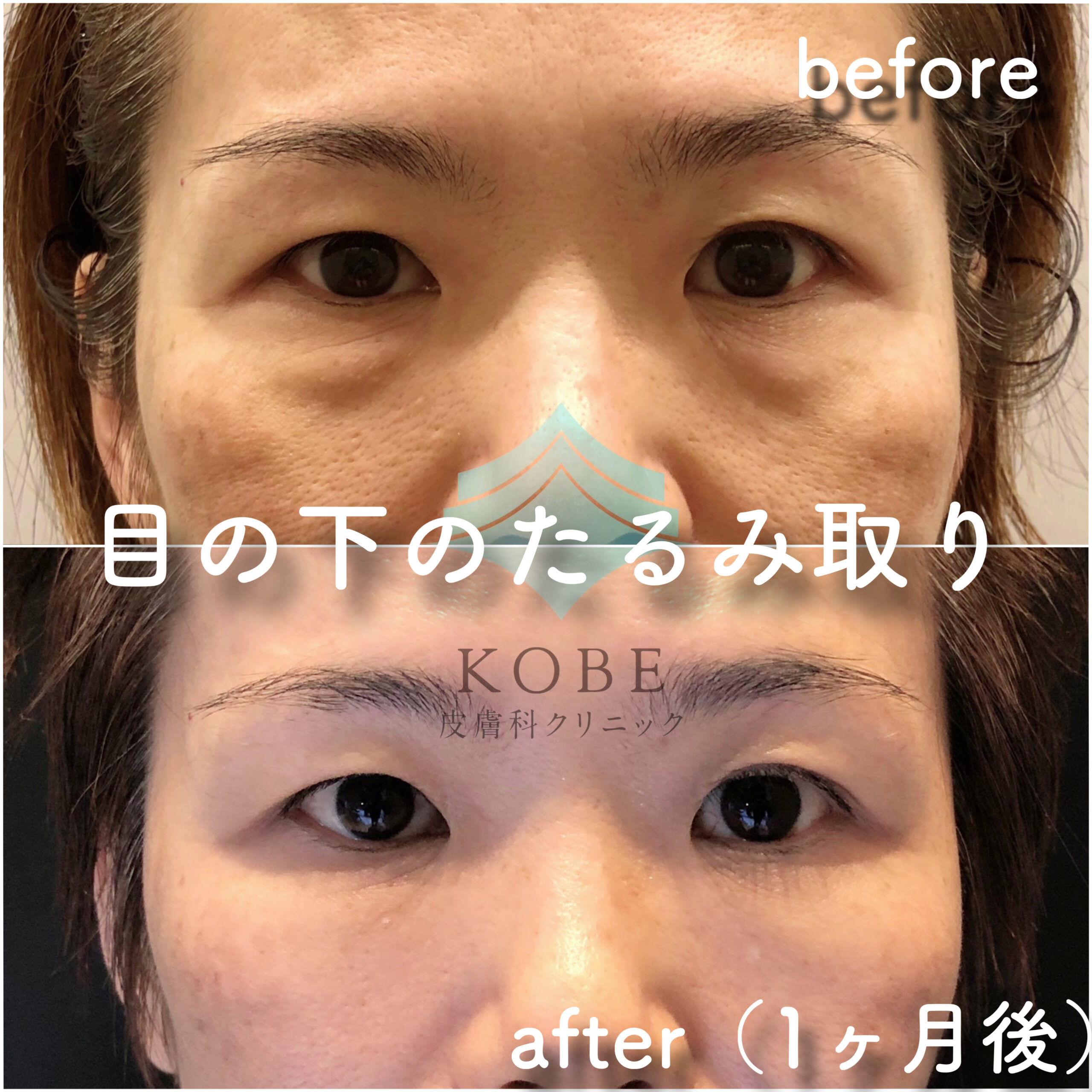 No.2869の症例写真 No.2869の症例写真