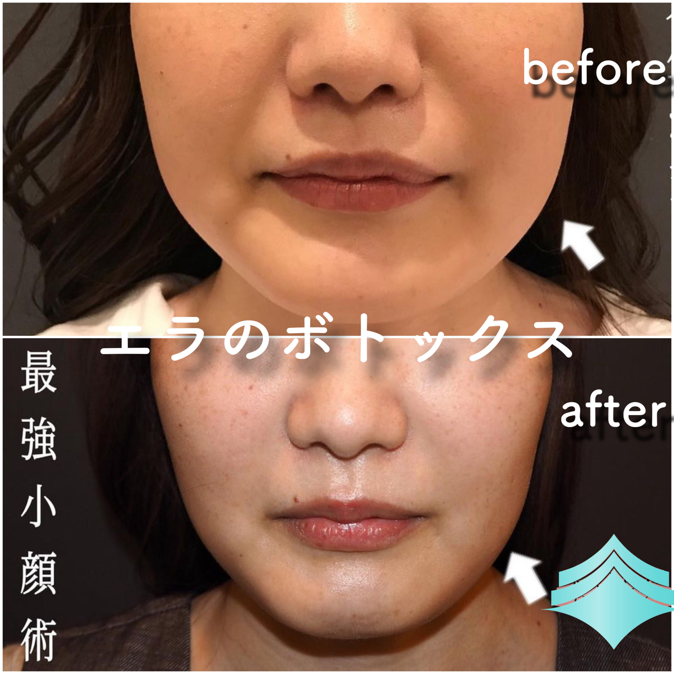 No.2815の症例写真 No.2815の症例写真