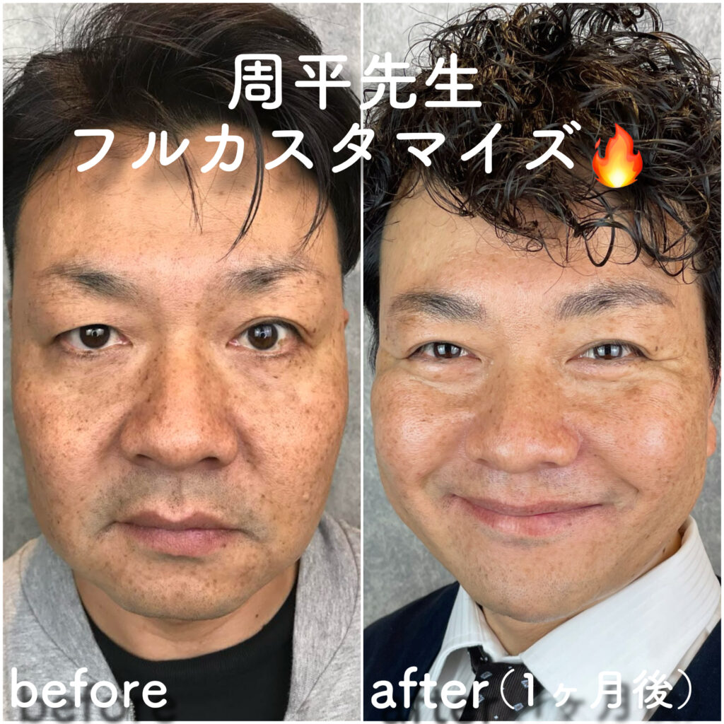 ビフォーアフター