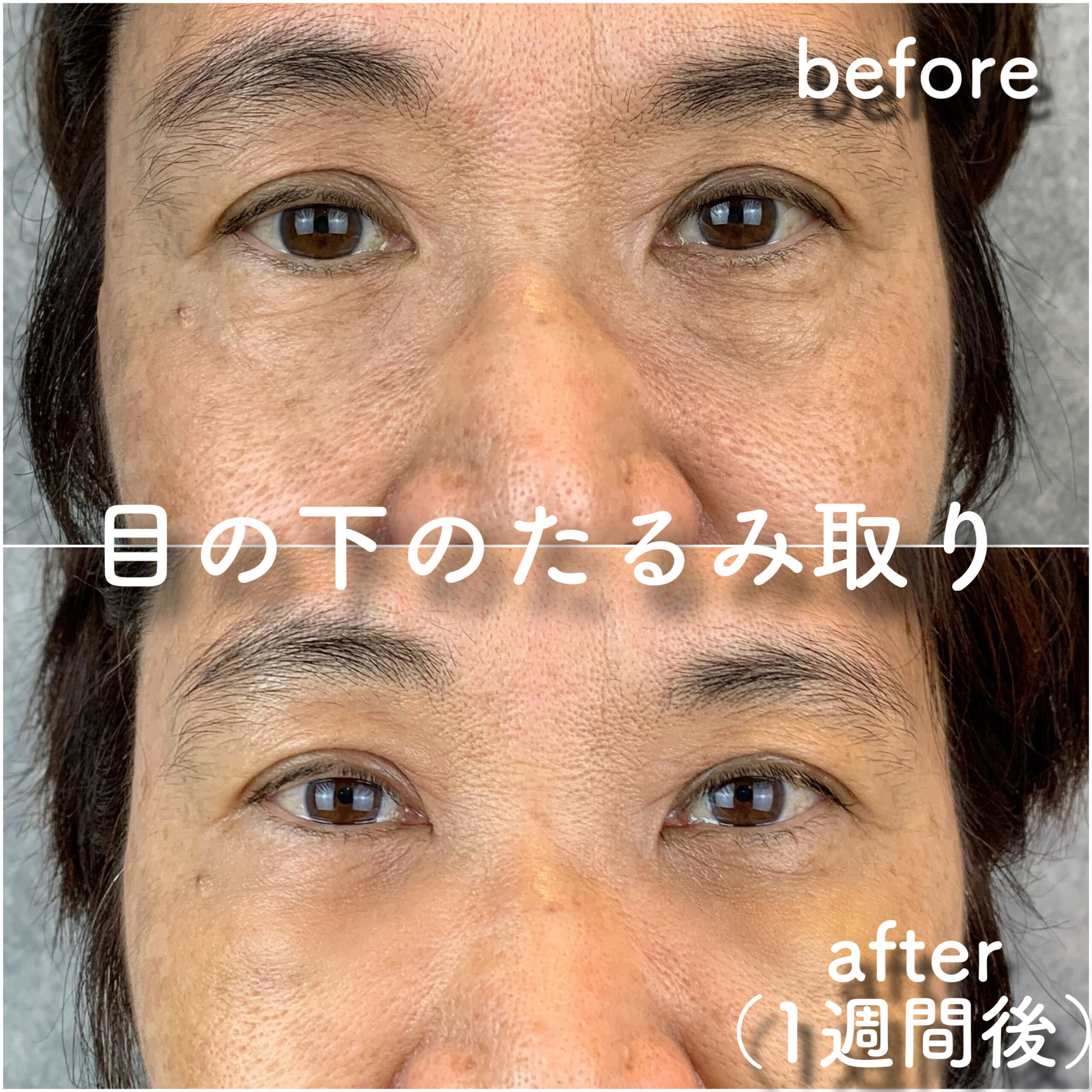 No.2894の症例写真 No.2894の症例写真