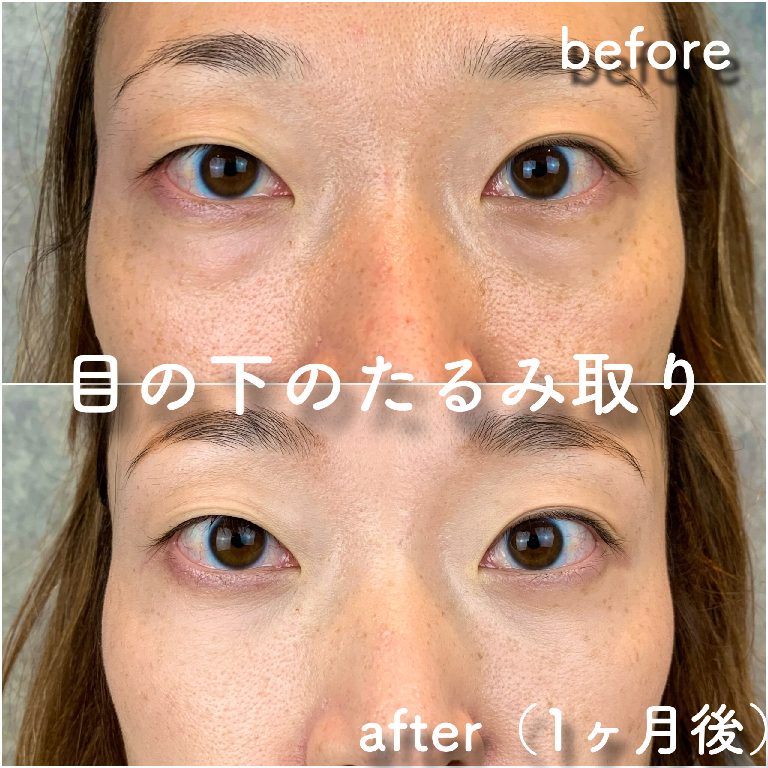 No.2880の症例写真 No.2880の症例写真