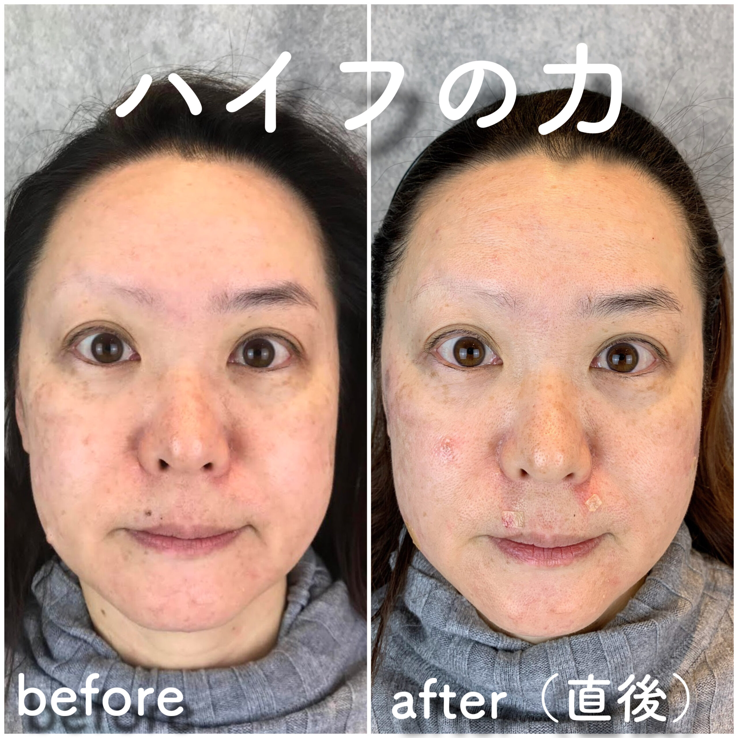 No.2780の症例写真 No.2780の症例写真