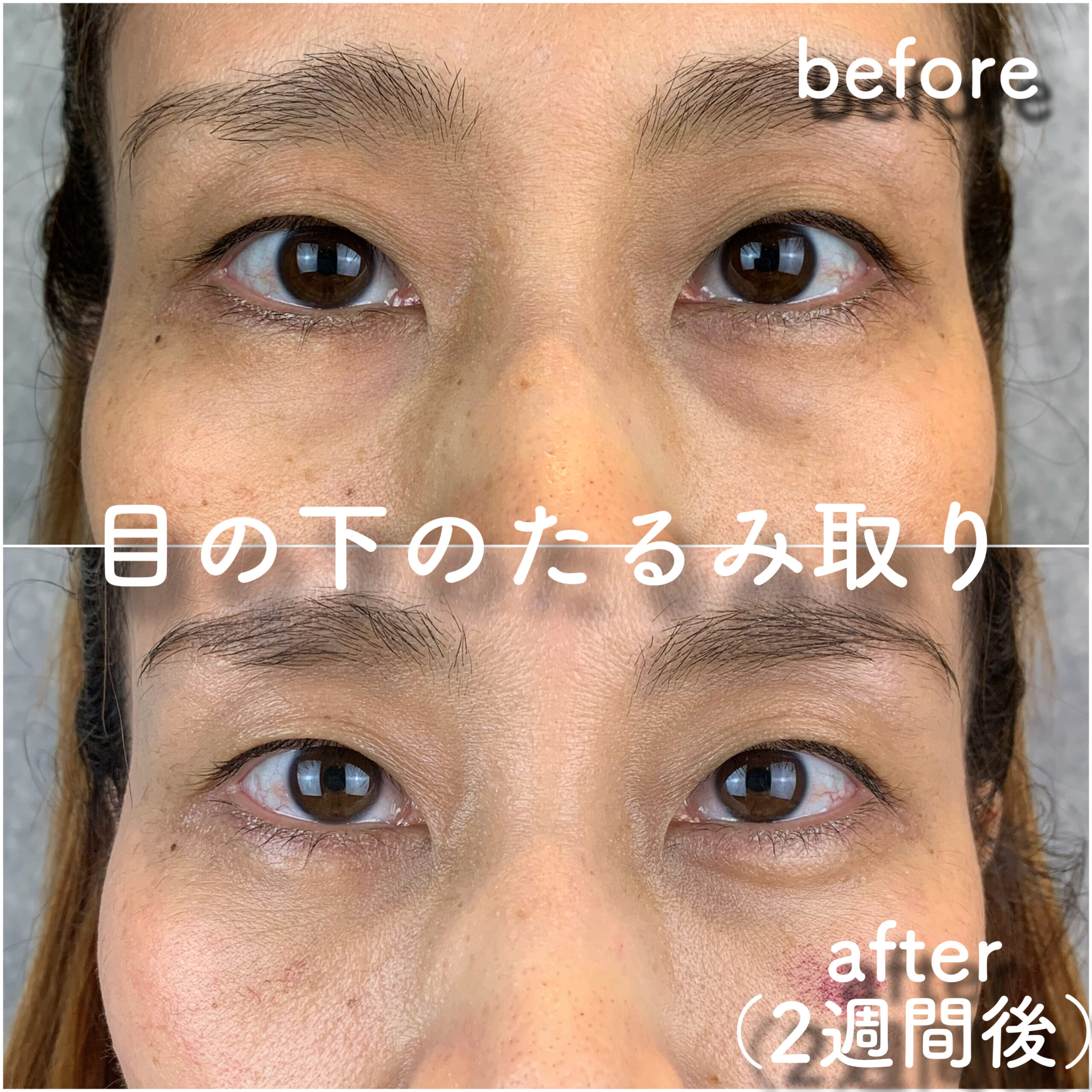 No.2864の症例写真 No.2864の症例写真