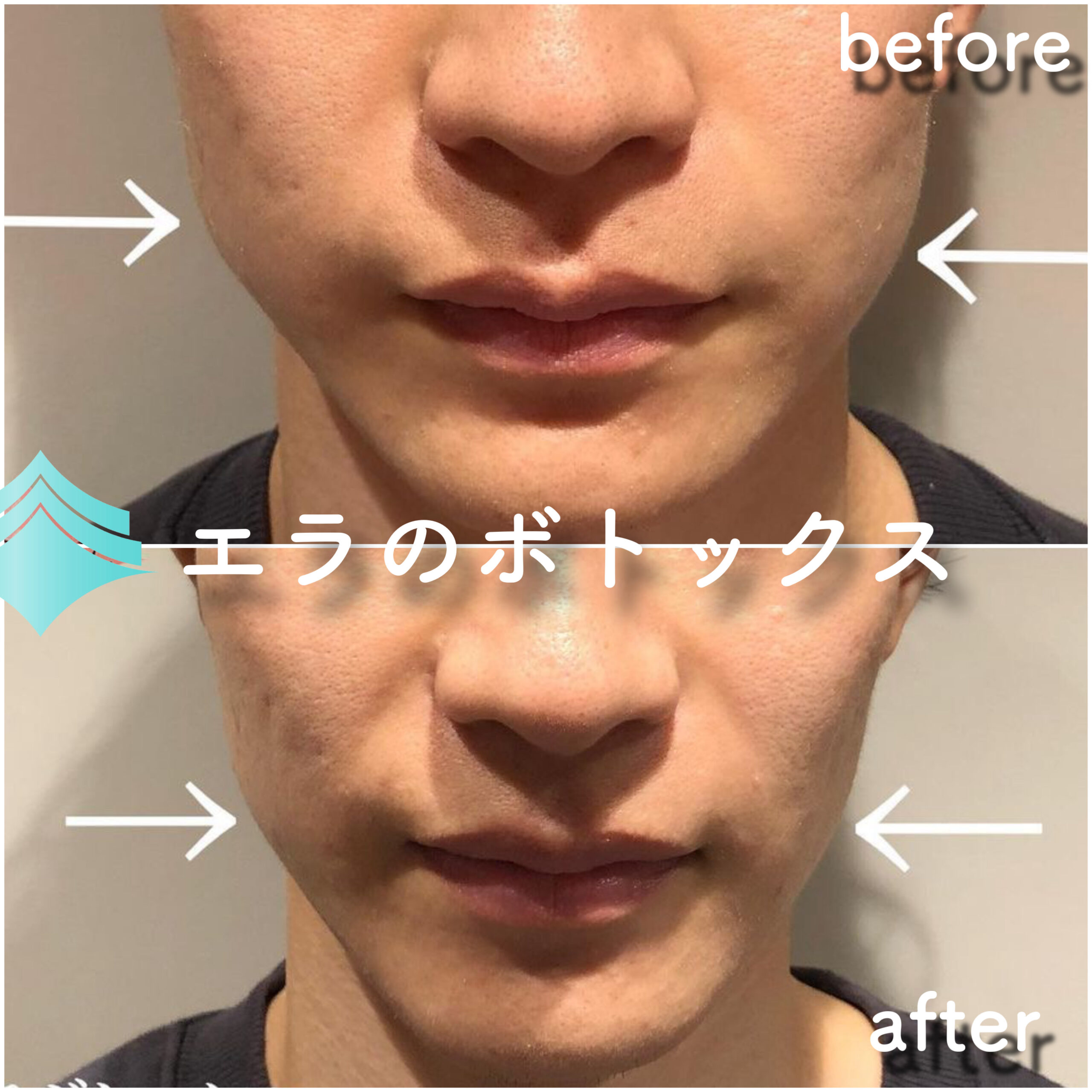 No.2820の症例写真 No.2820の症例写真