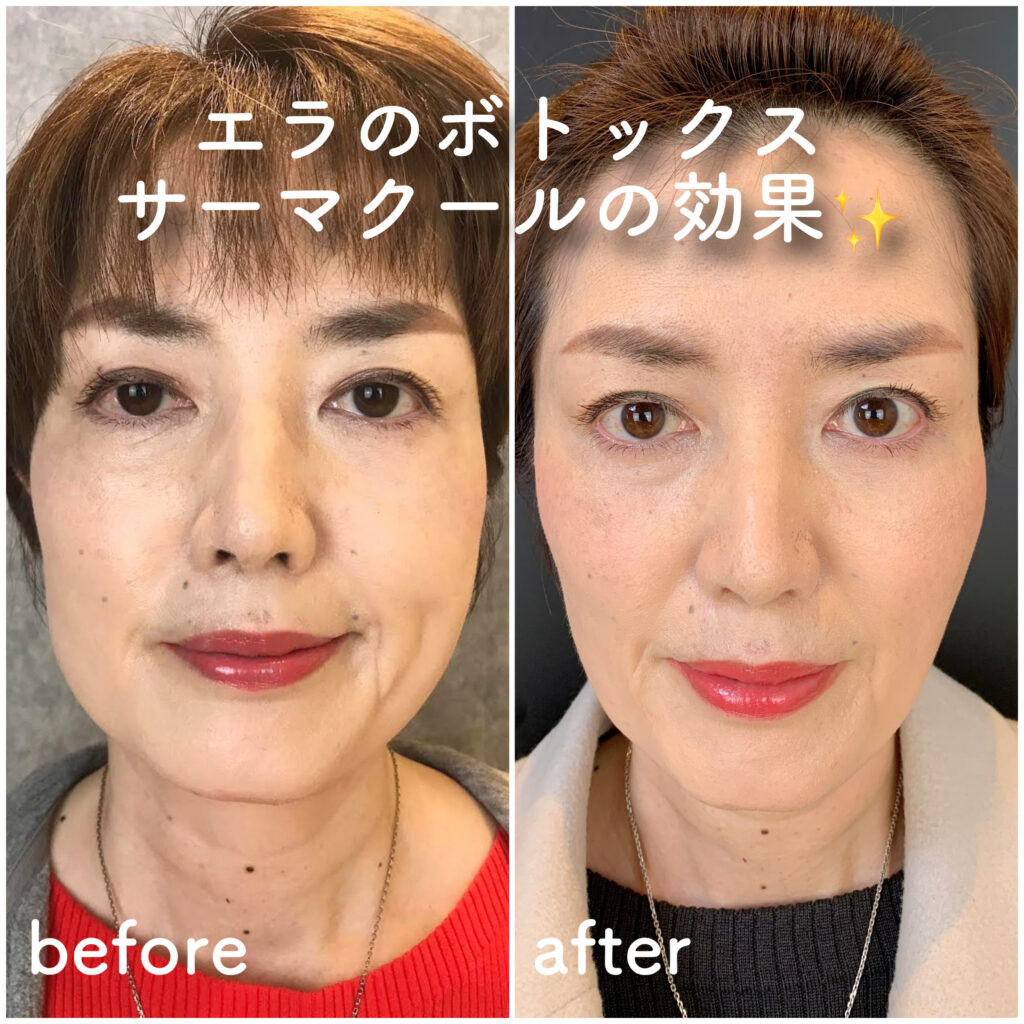 ビフォーアフター