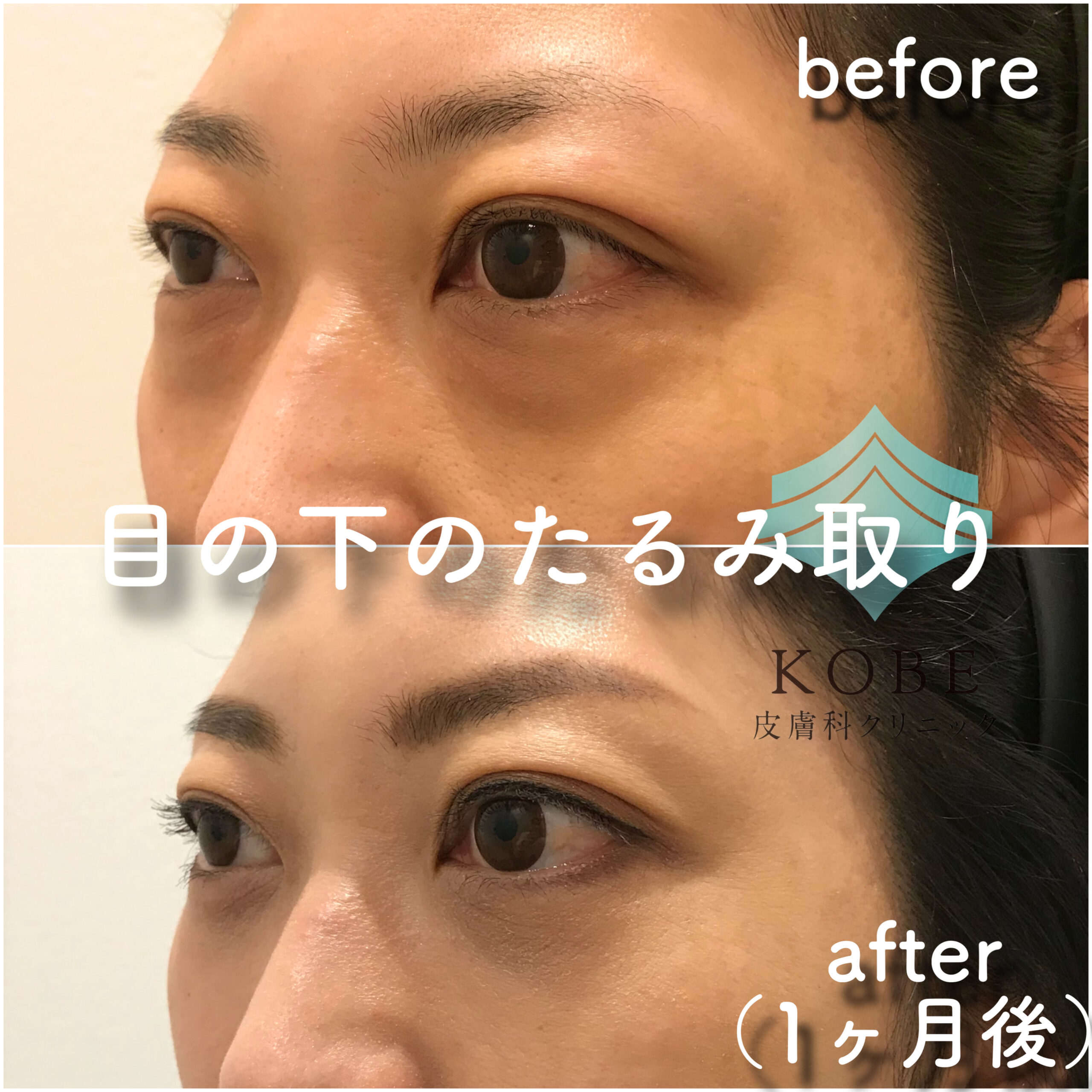 No.2842の症例写真 No.2842の症例写真