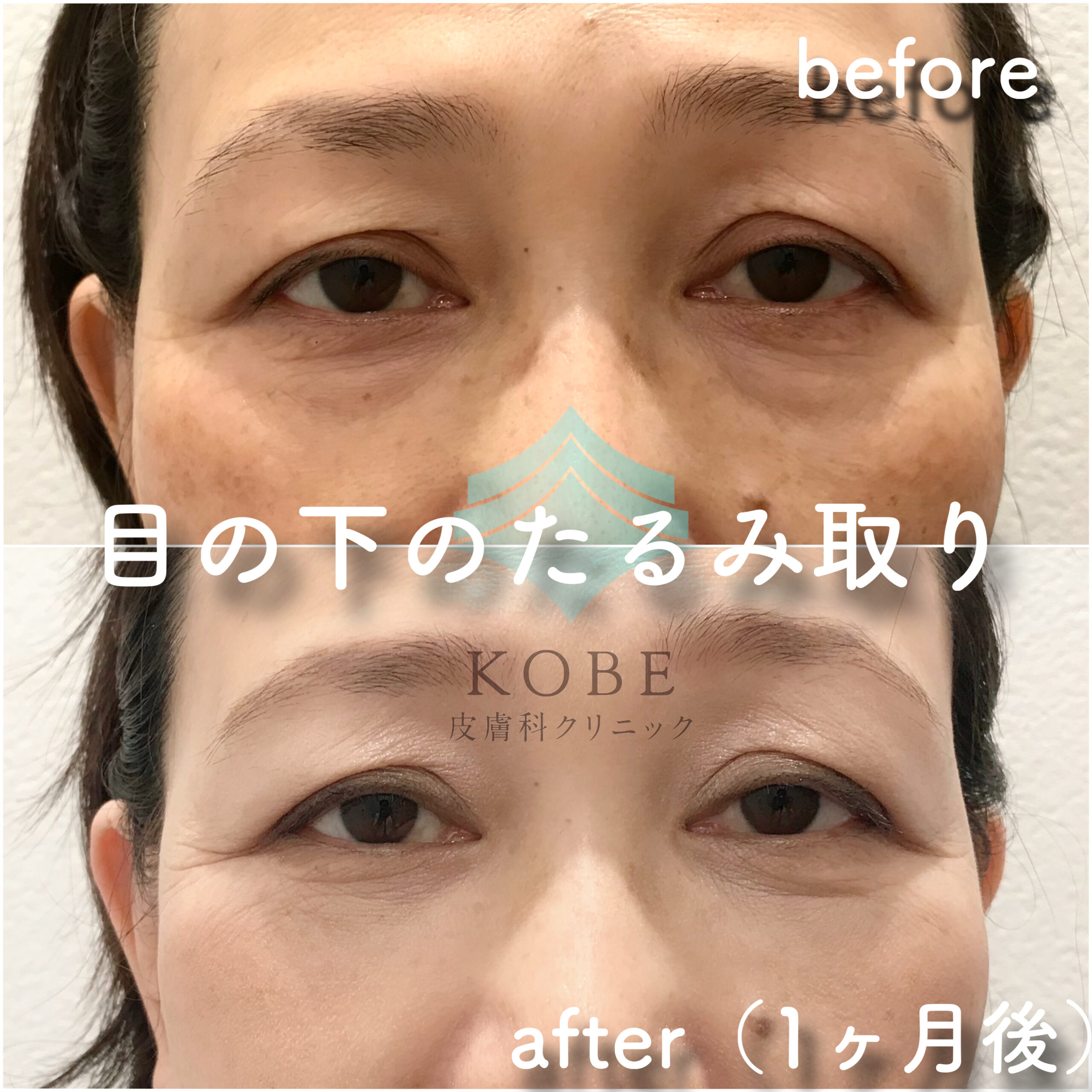 No.2834の症例写真 No.2834の症例写真