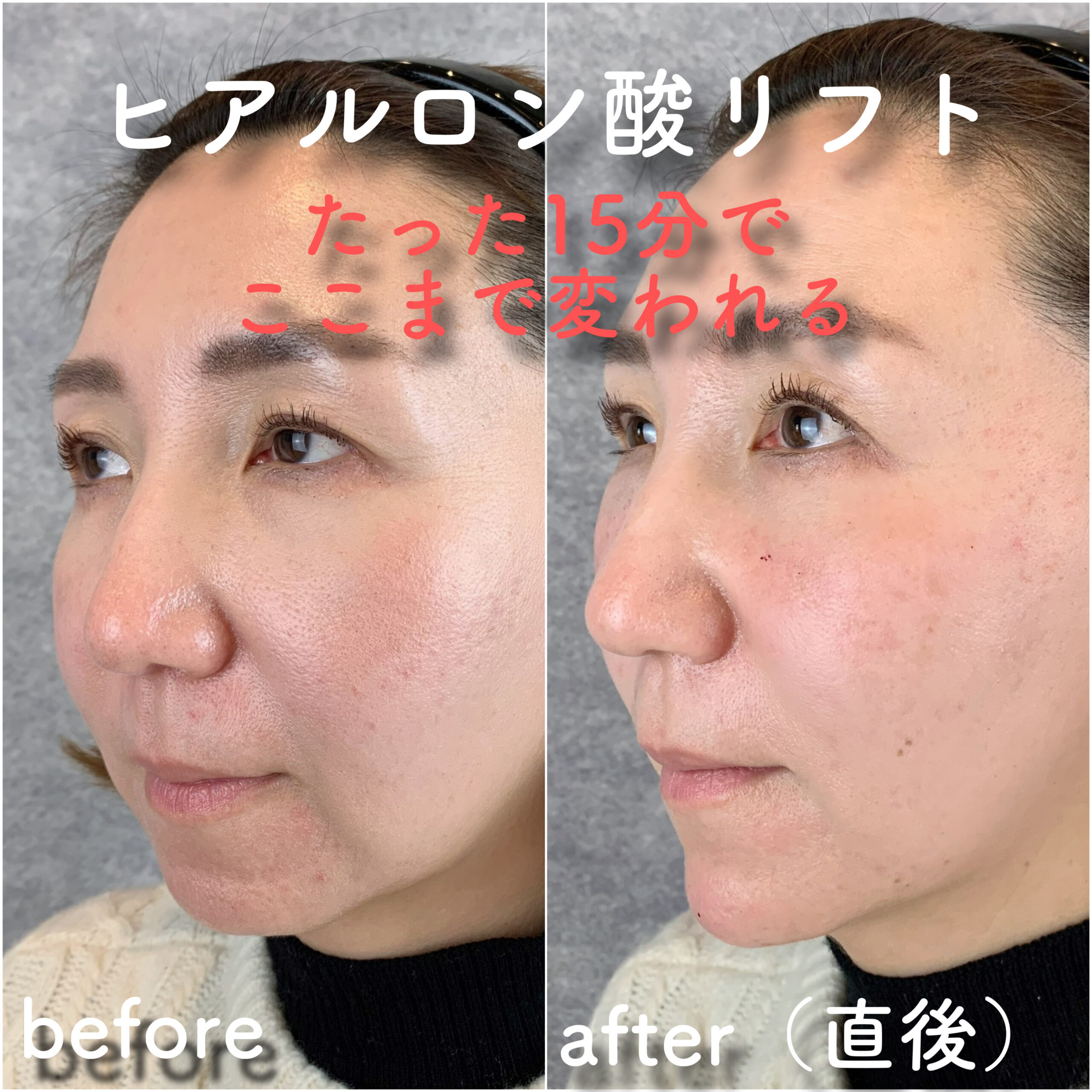 No.3602の症例写真 No.3602の症例写真