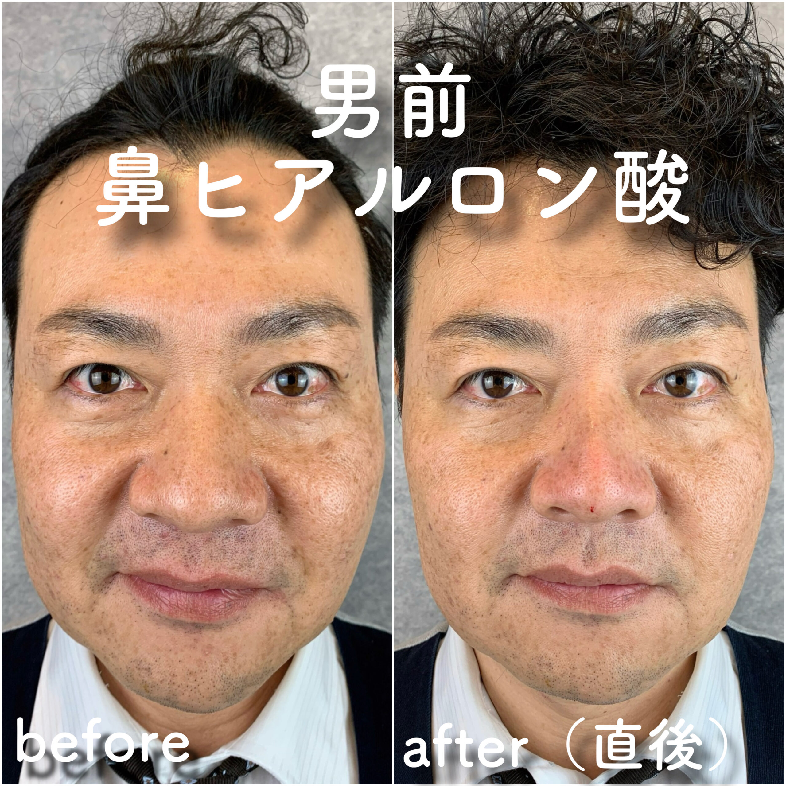 No.3622の症例写真 No.3622の症例写真