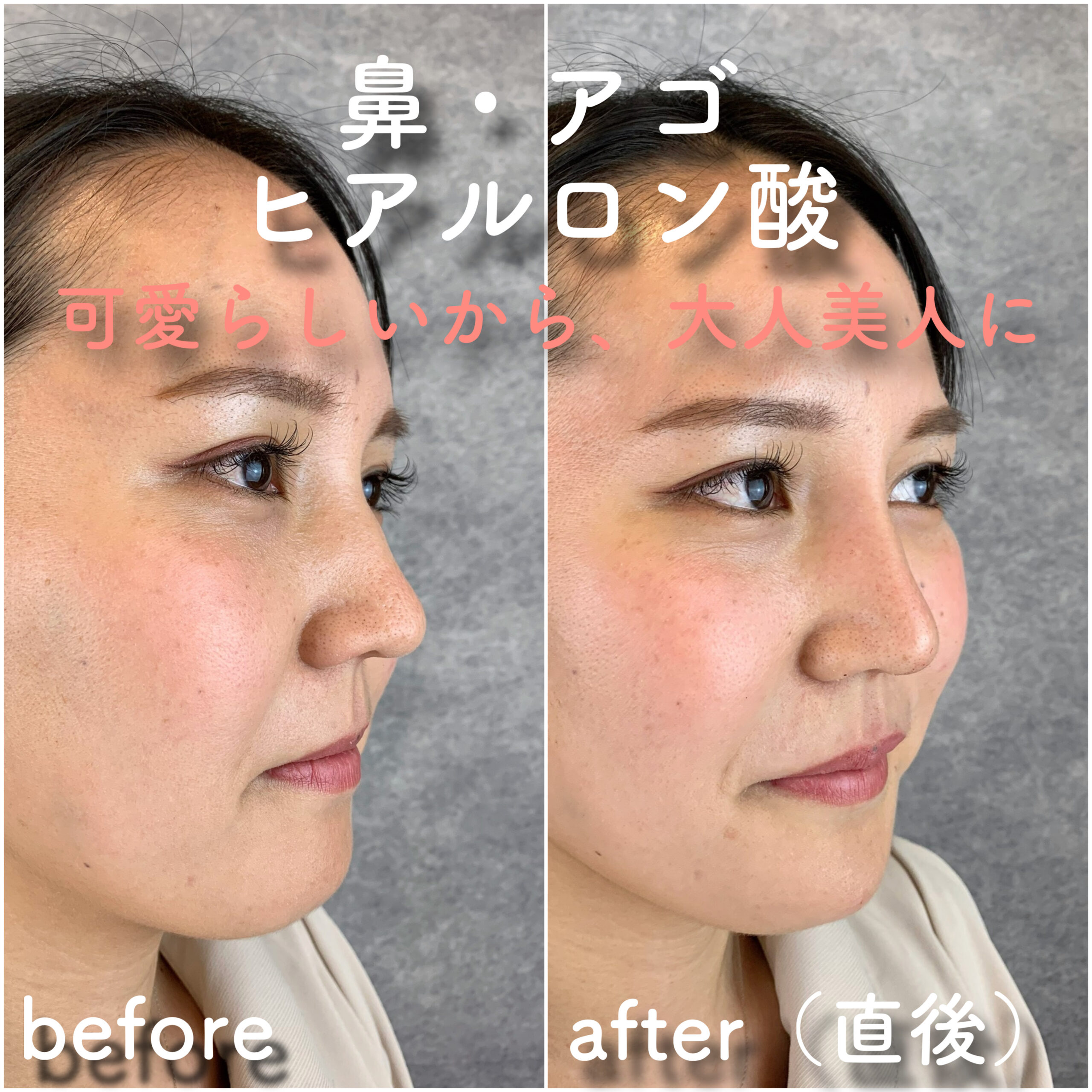 No.3596の症例写真 No.3596の症例写真