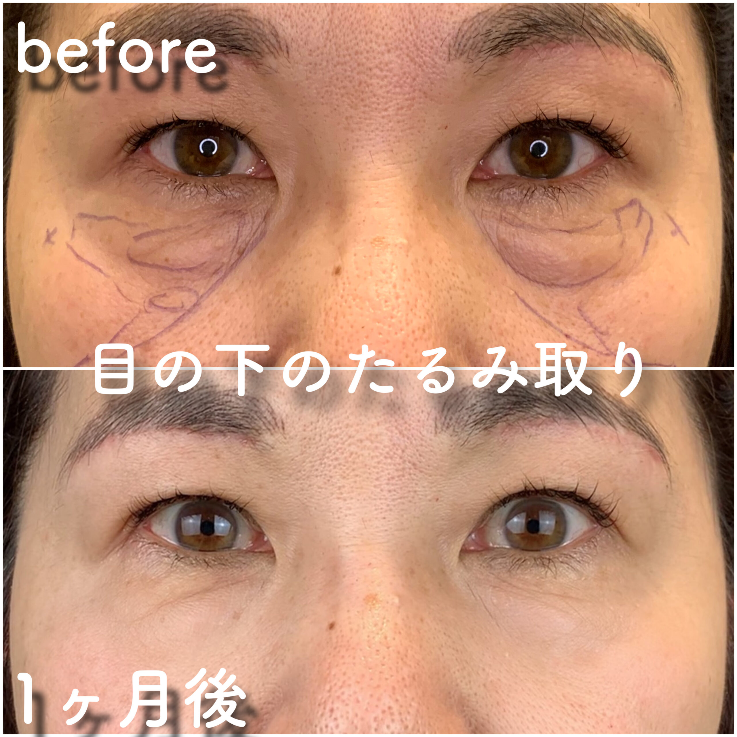 No.3547の症例写真 No.3547の症例写真