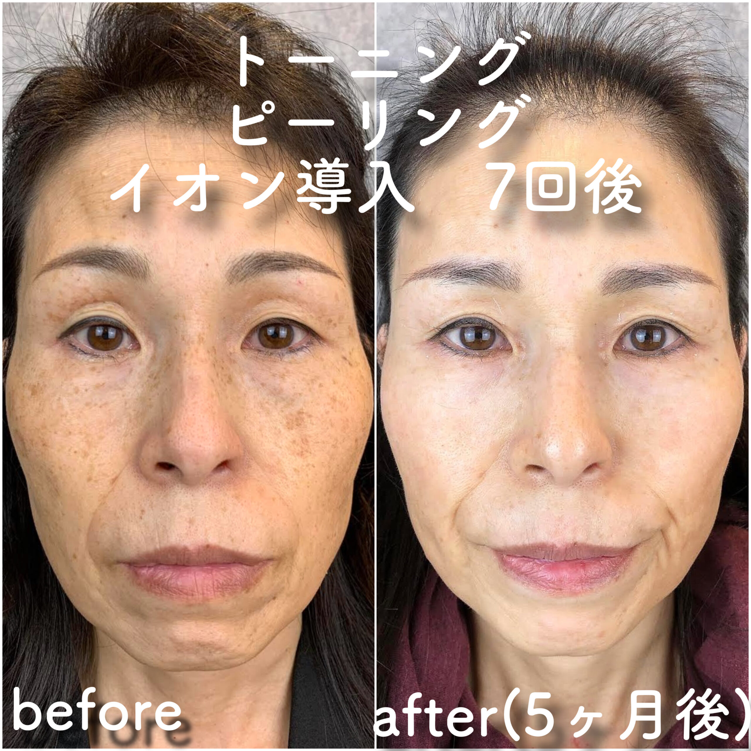 No.3579の症例写真 No.3579の症例写真