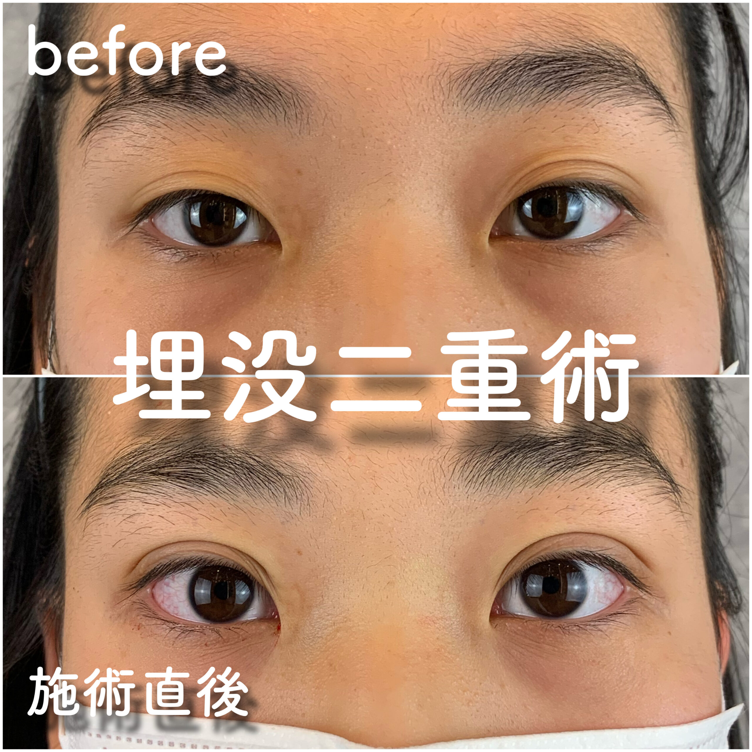 No.3640の症例写真 No.3640の症例写真