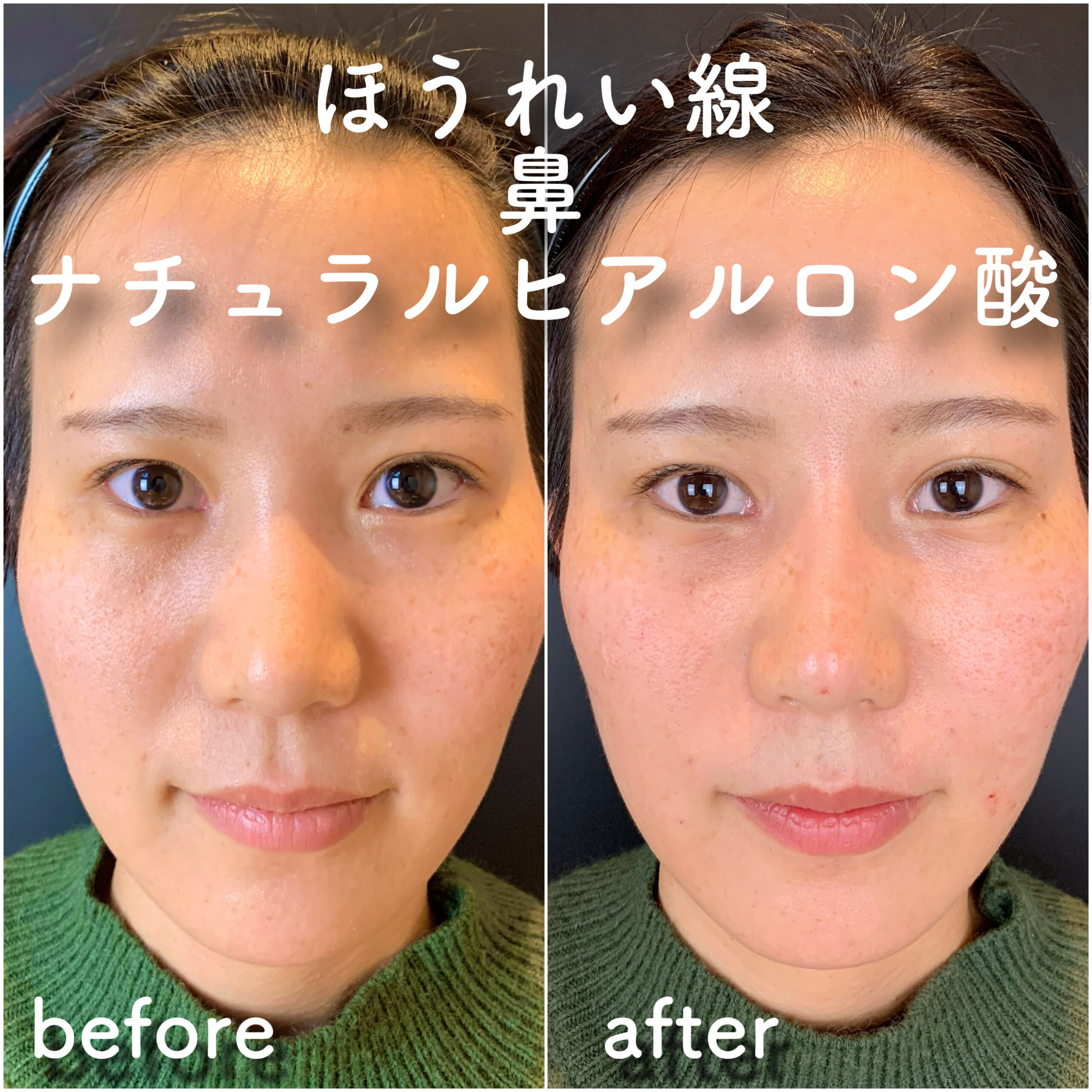 No.3613の症例写真 No.3613の症例写真