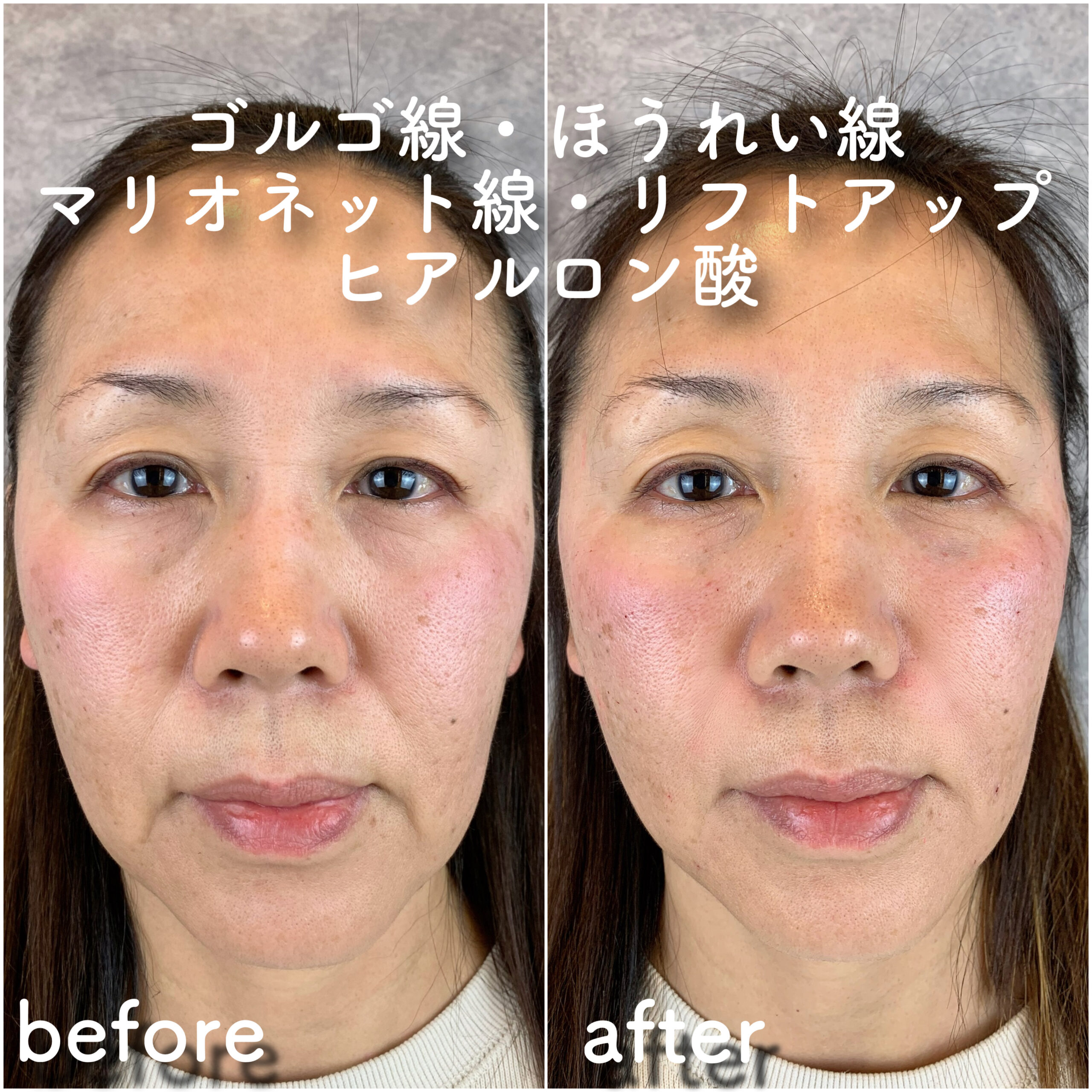 No.3619の症例写真 No.3619の症例写真