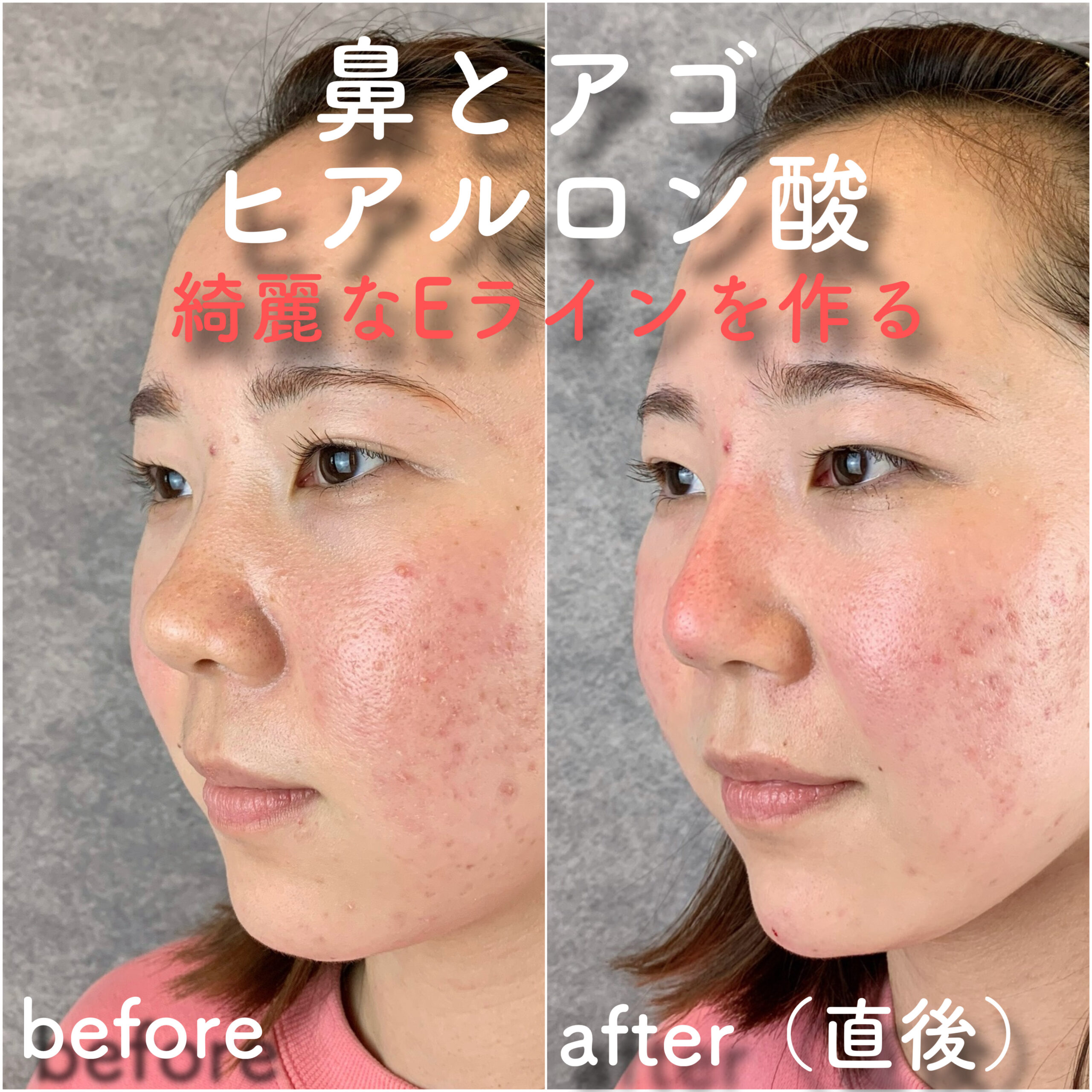 No.3591の症例写真 No.3591の症例写真