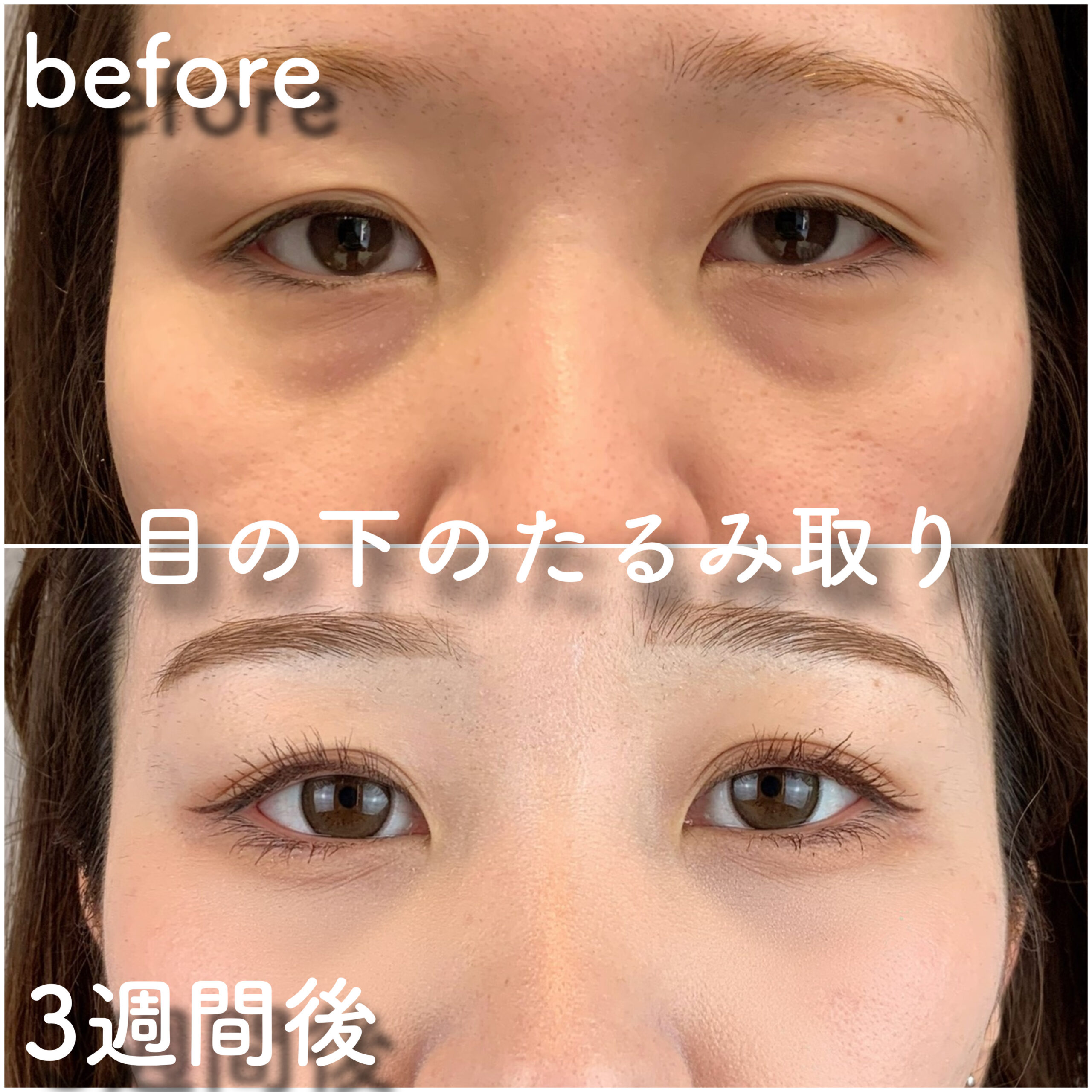 No.3538の症例写真 No.3538の症例写真
