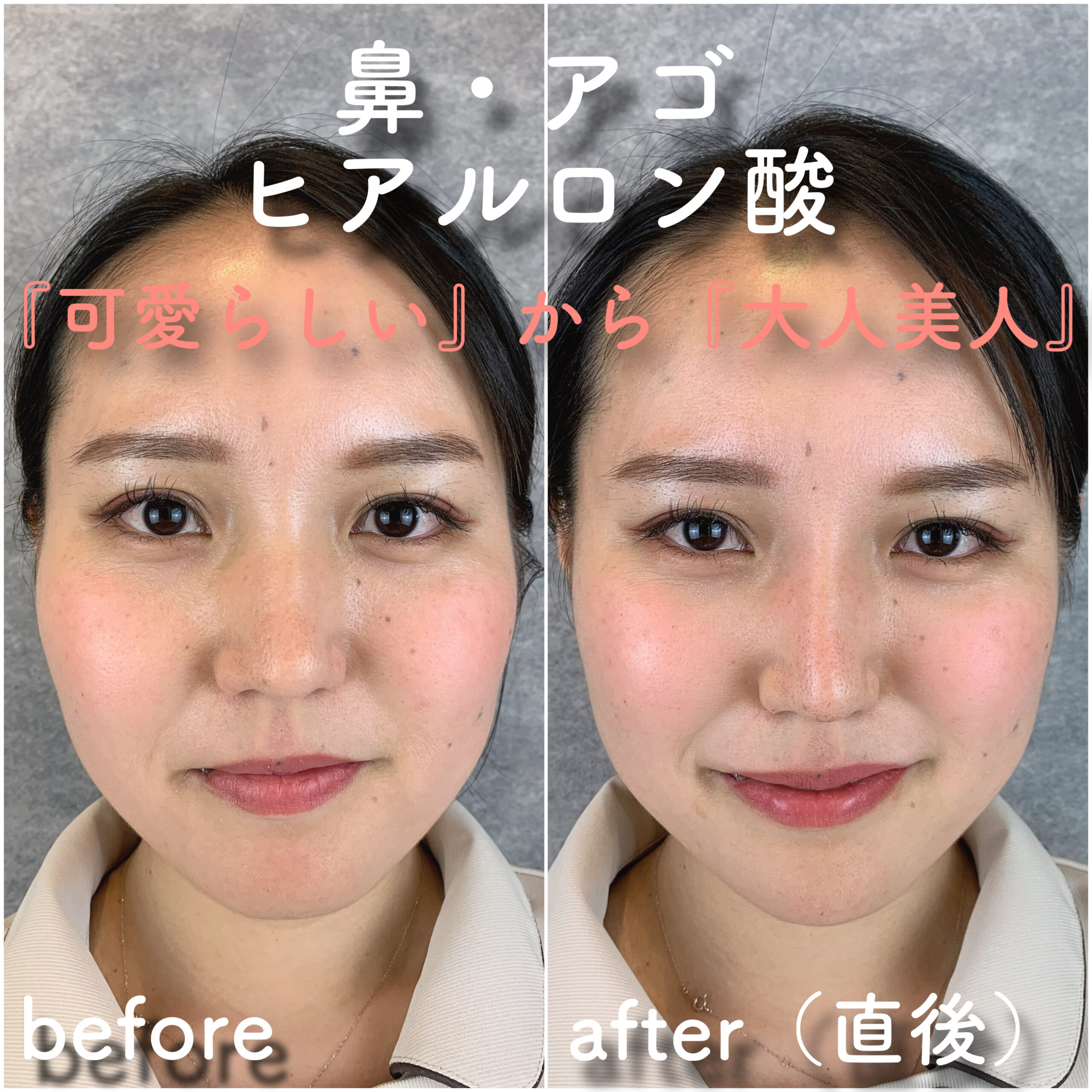 No.3626の症例写真 No.3626の症例写真