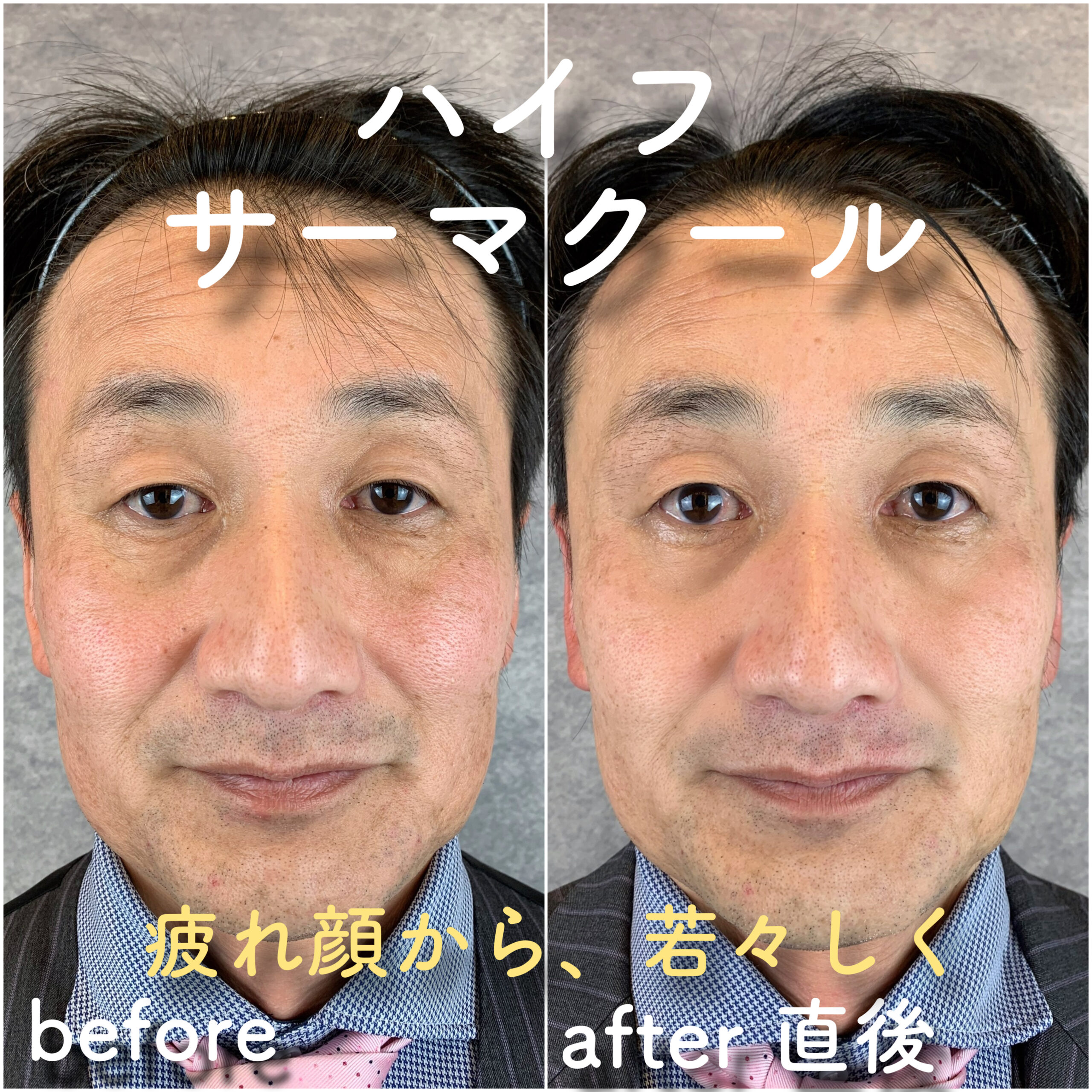 No.3531の症例写真 No.3531の症例写真