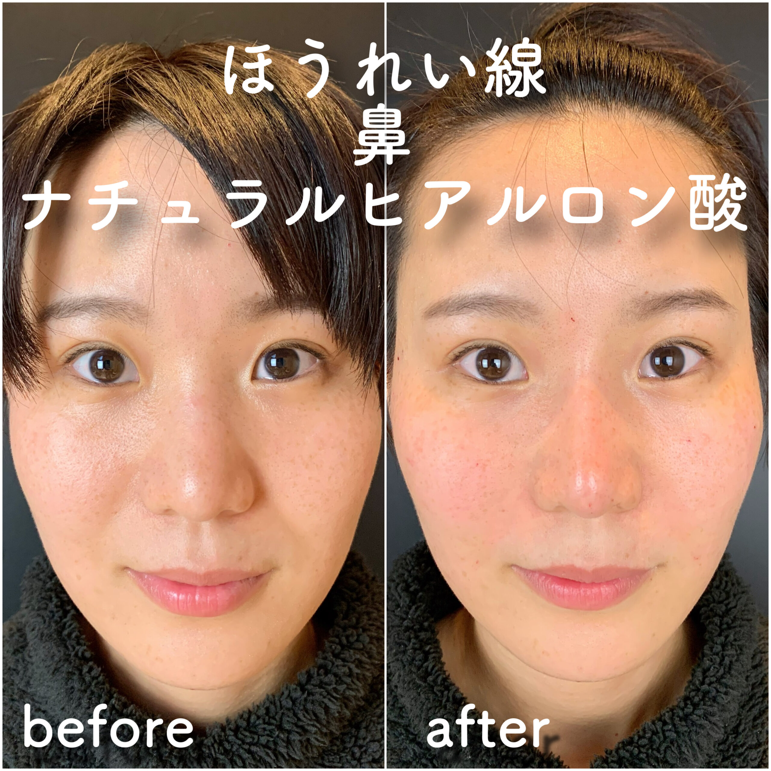No.3609の症例写真 No.3609の症例写真