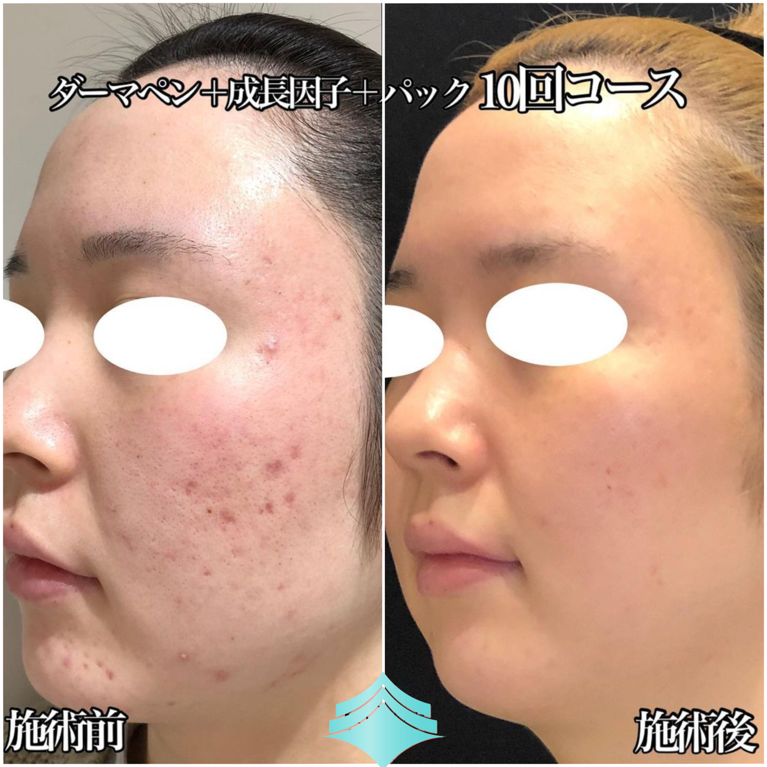 No.4199の症例写真 No.4199の症例写真
