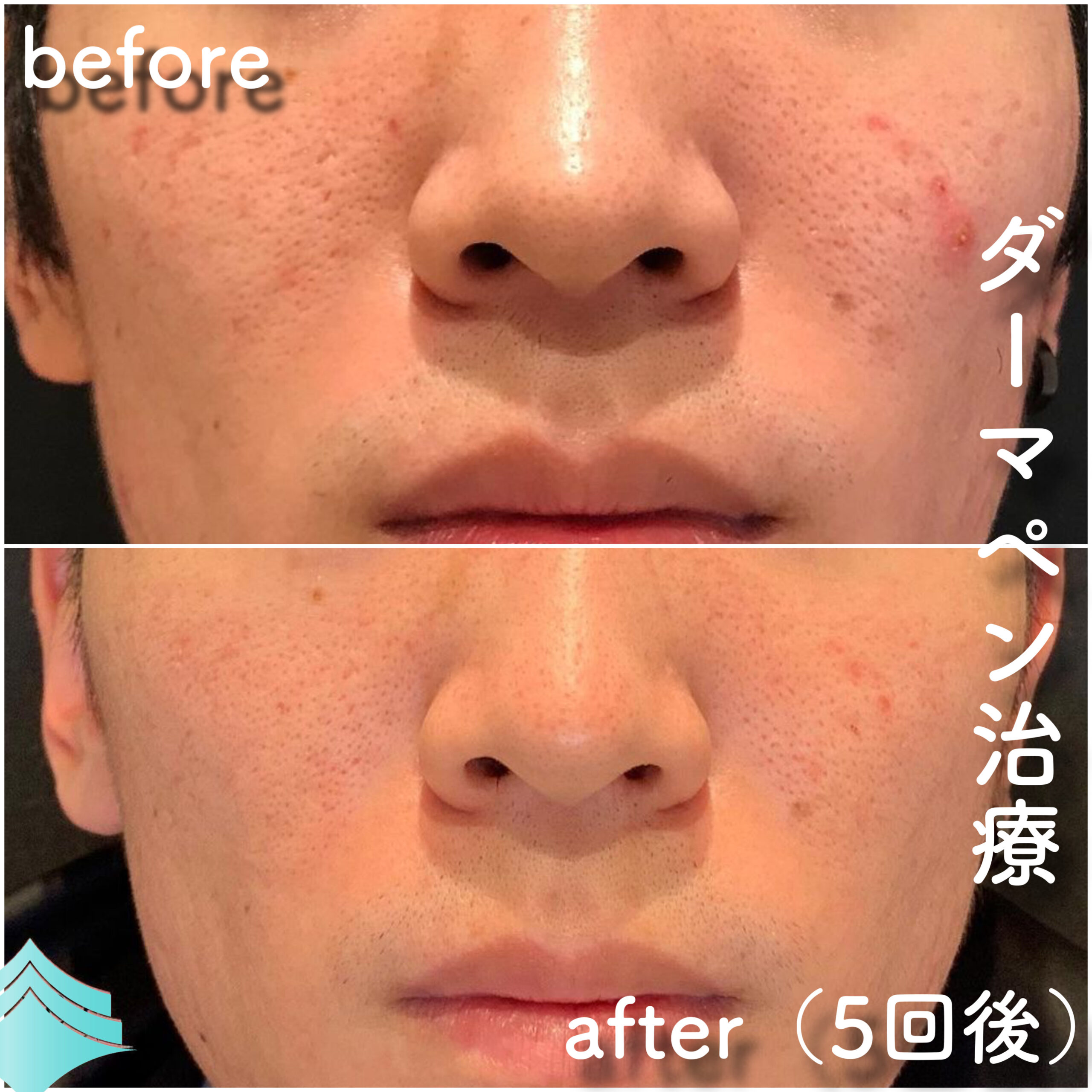 No.4196の症例写真 No.4196の症例写真