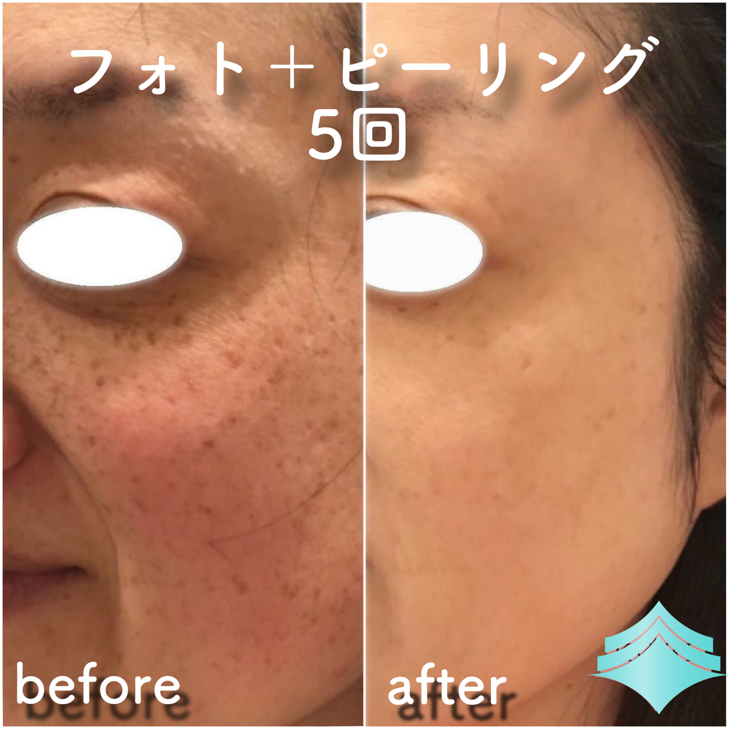 No.4216の症例写真 No.4216の症例写真