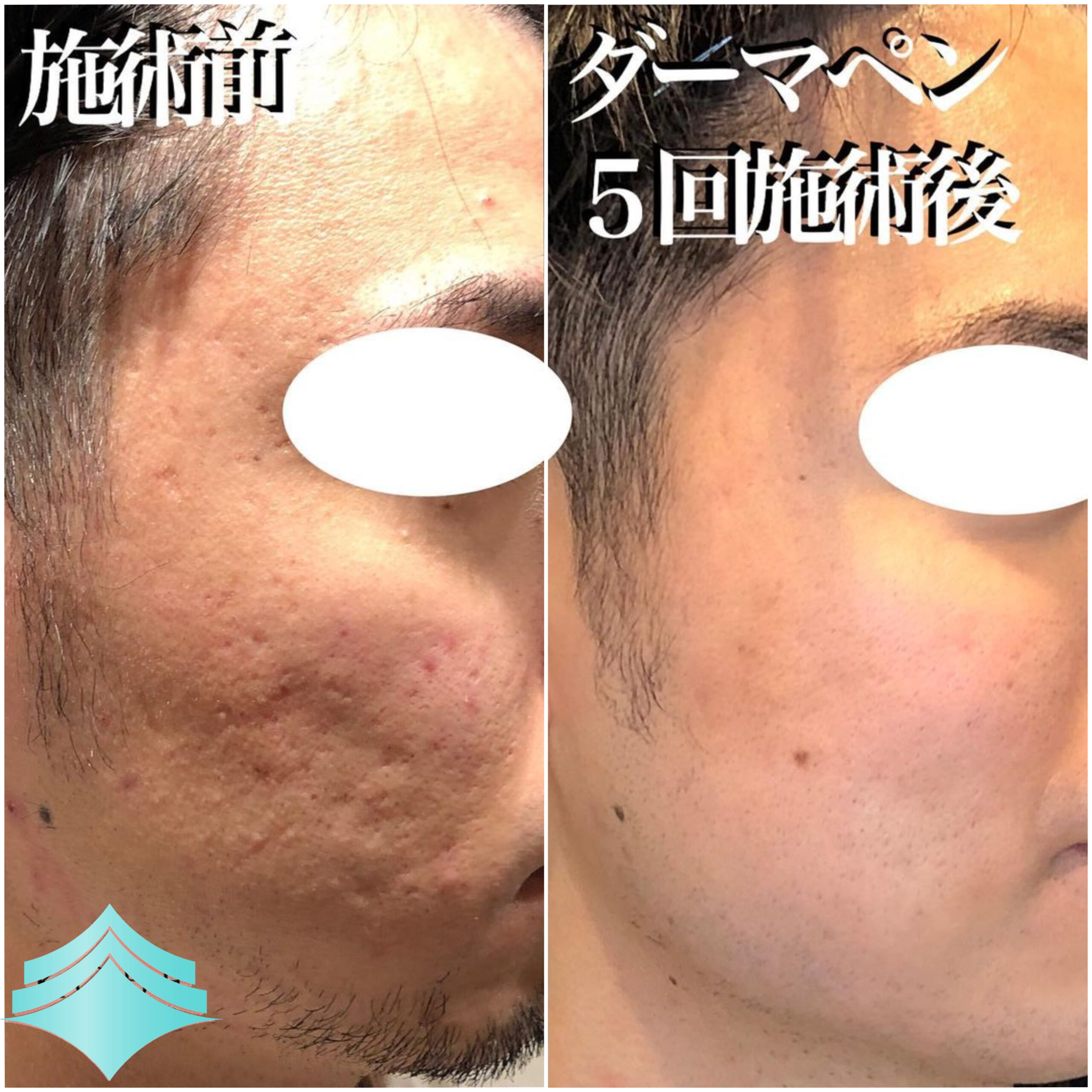 No.4193の症例写真 No.4193の症例写真