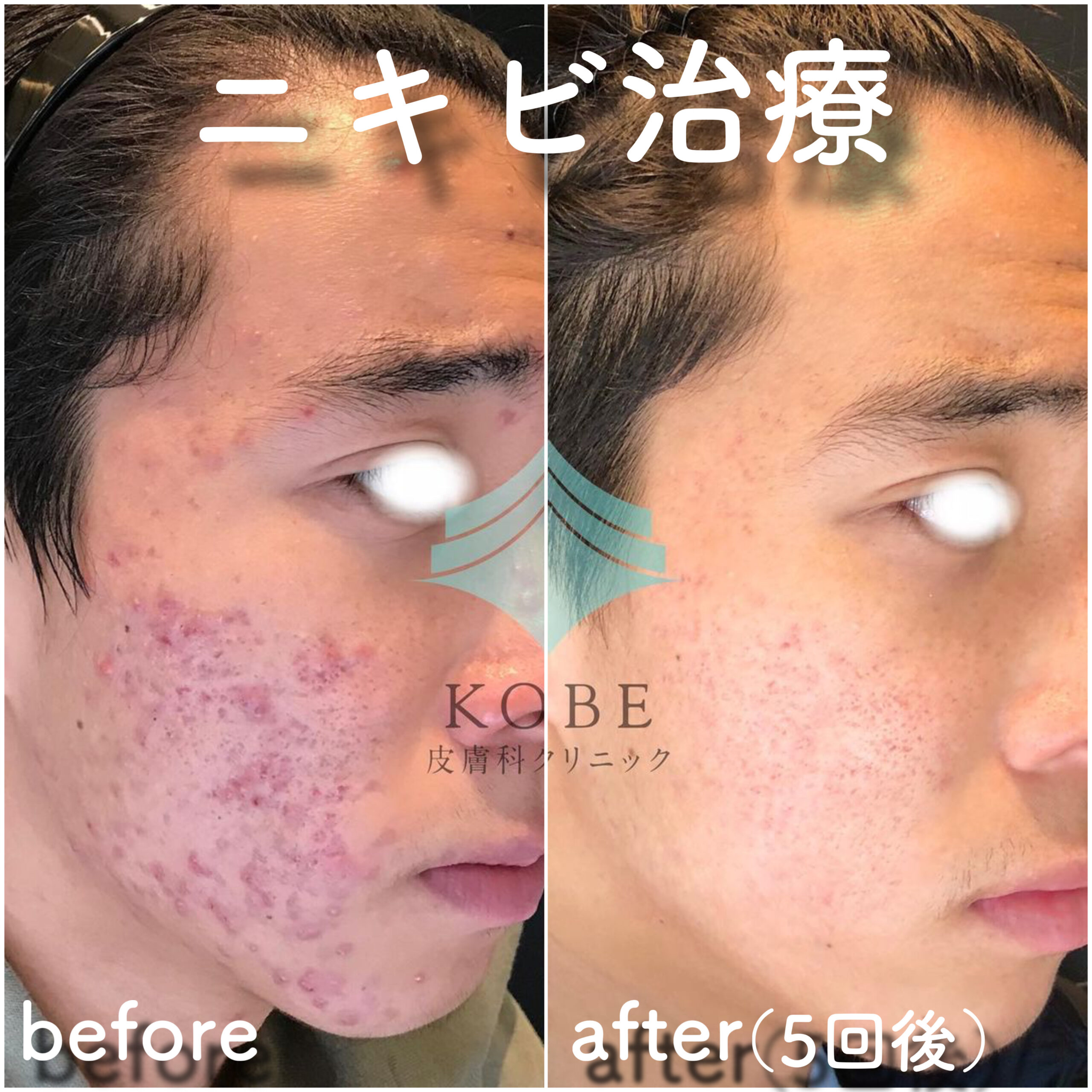 No.4180の症例写真 No.4180の症例写真