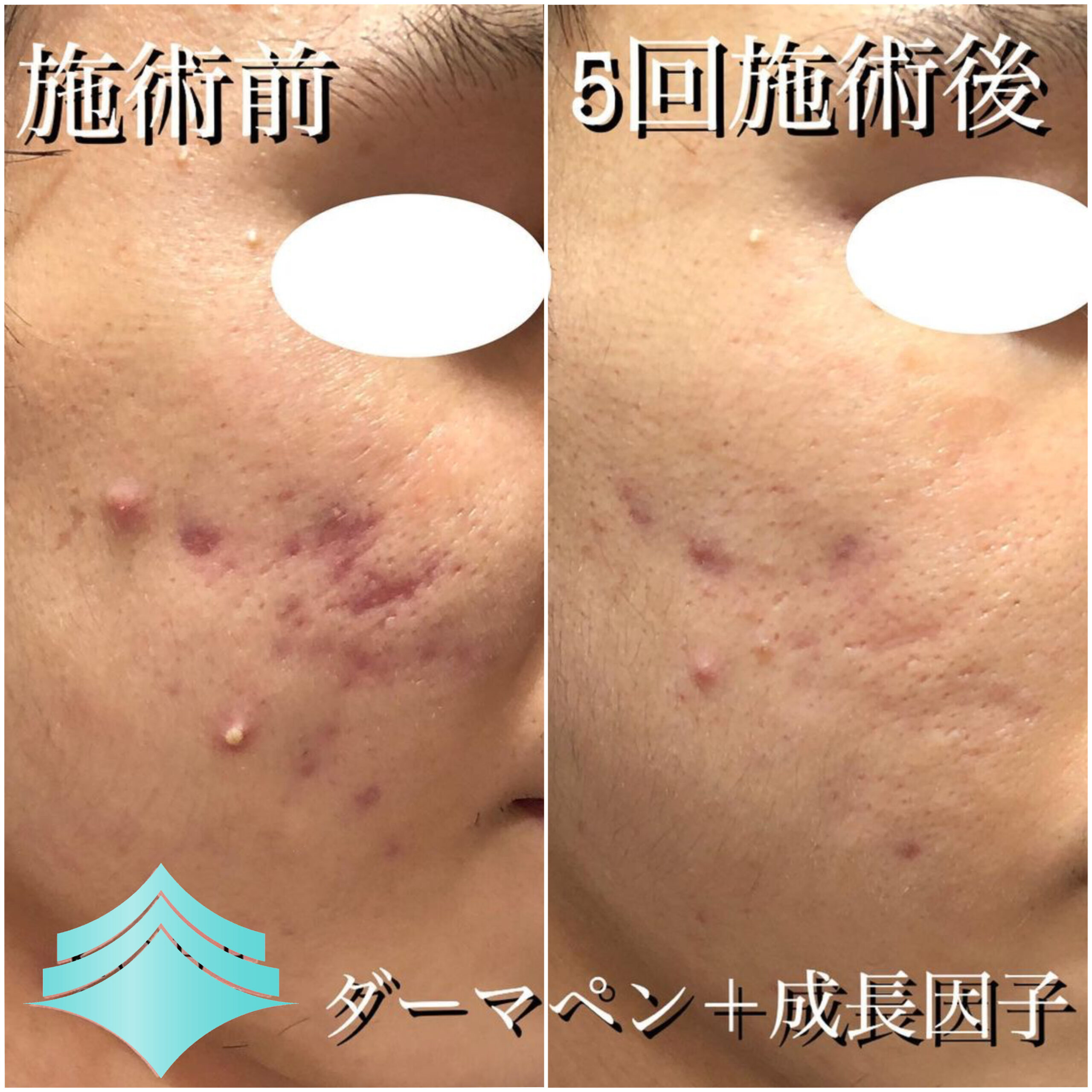 No.4186の症例写真 No.4186の症例写真