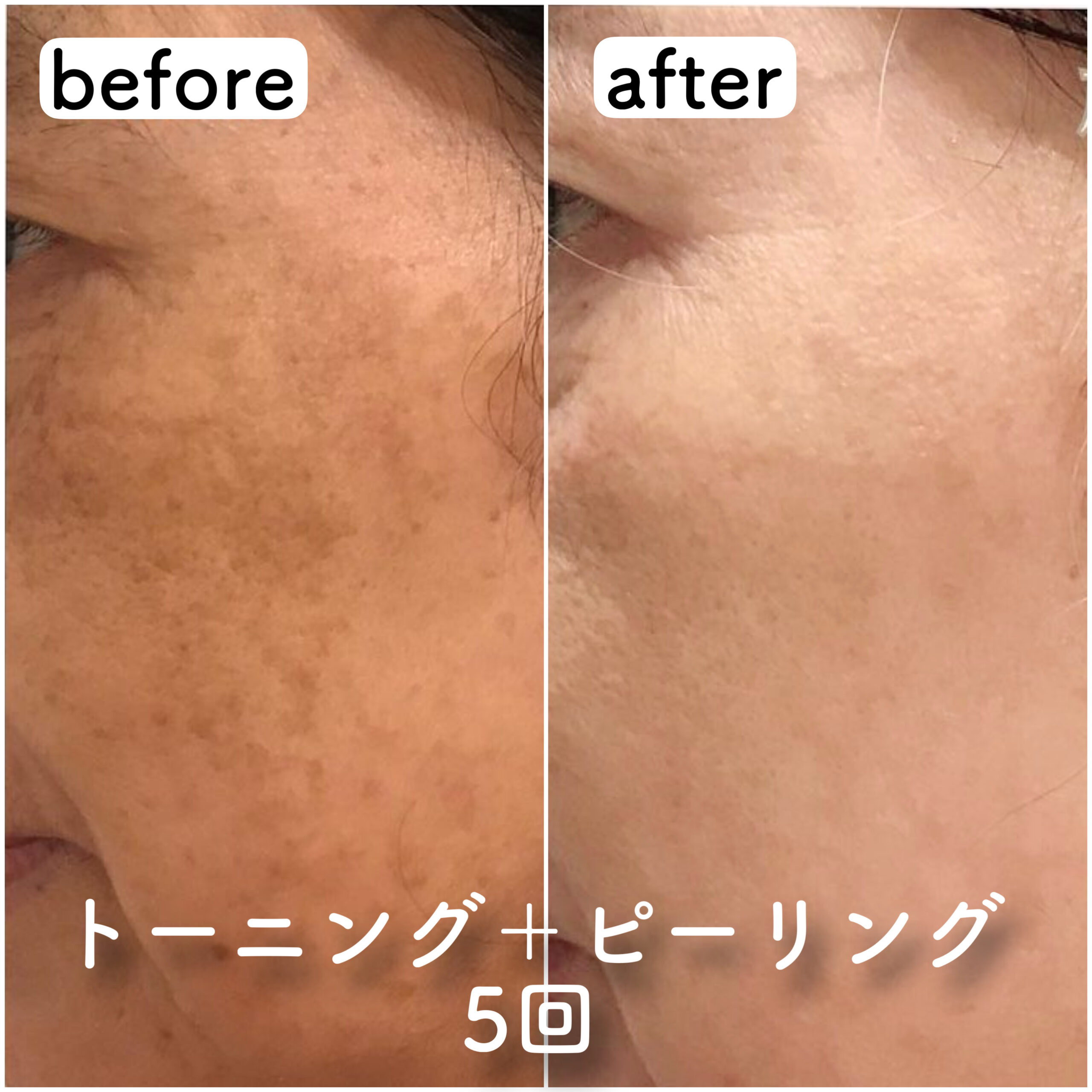 No.4259の症例写真