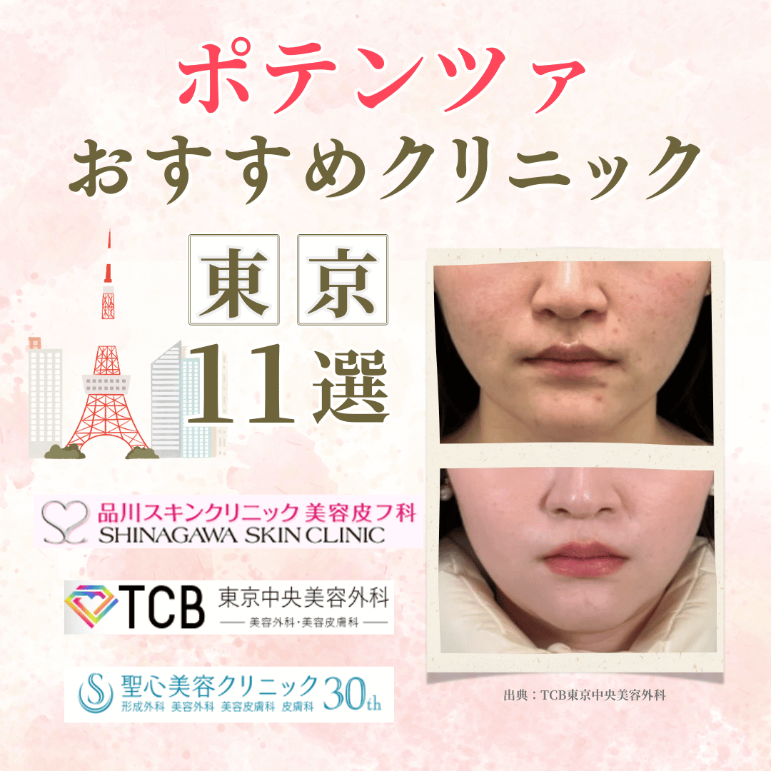 東京のポテンツァおすすめクリニック11選