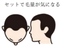 セットで毛量が気になる