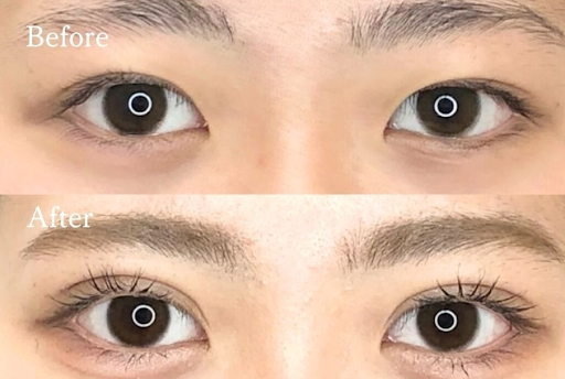 共立美容外科の症例
