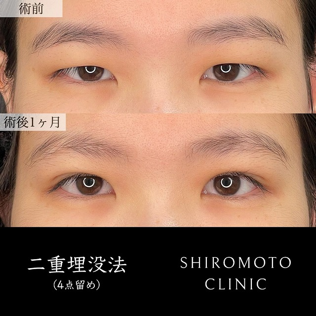 城本クリニックの症例