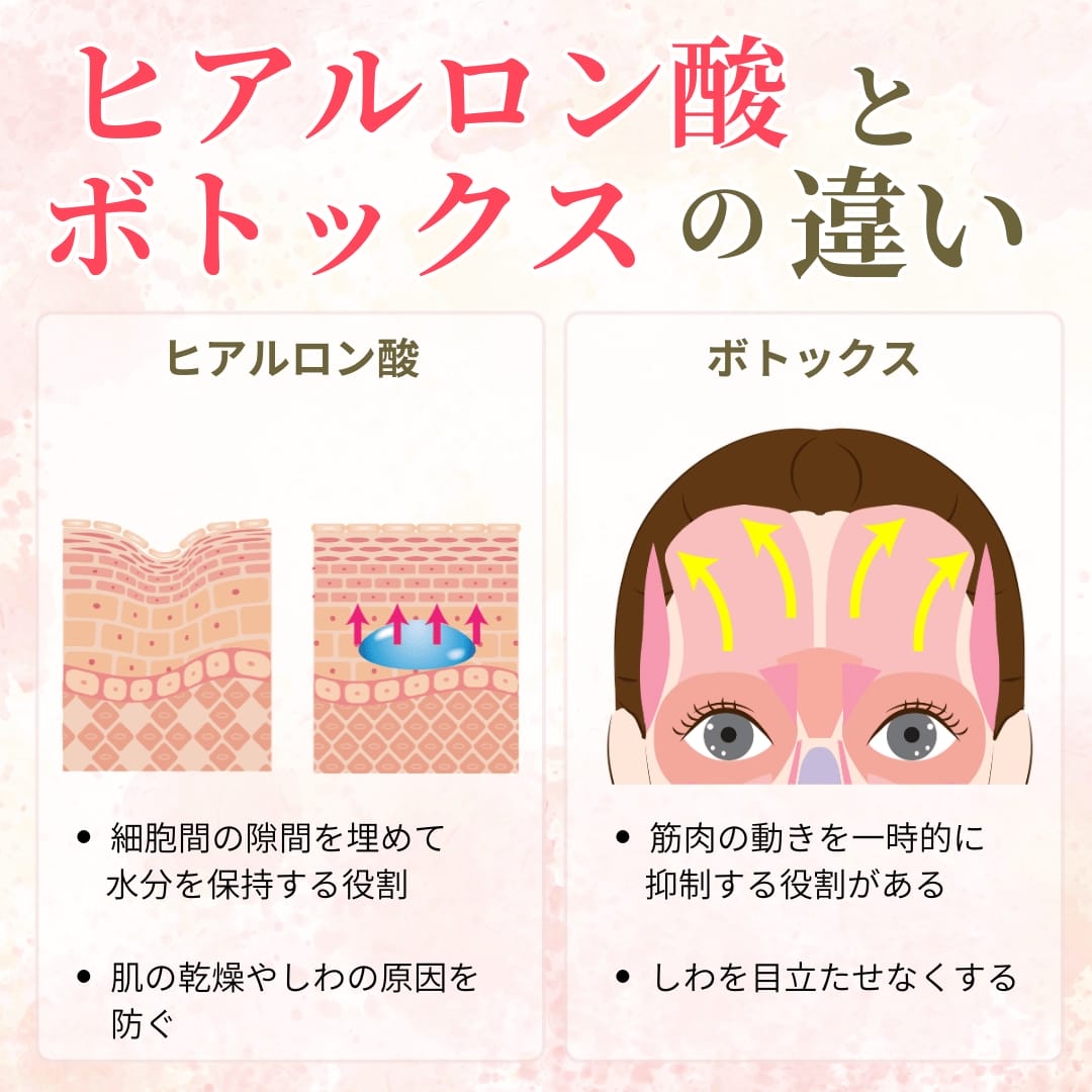 ヒアルロン酸とボトックスのおでこのシワに対する効果の違い