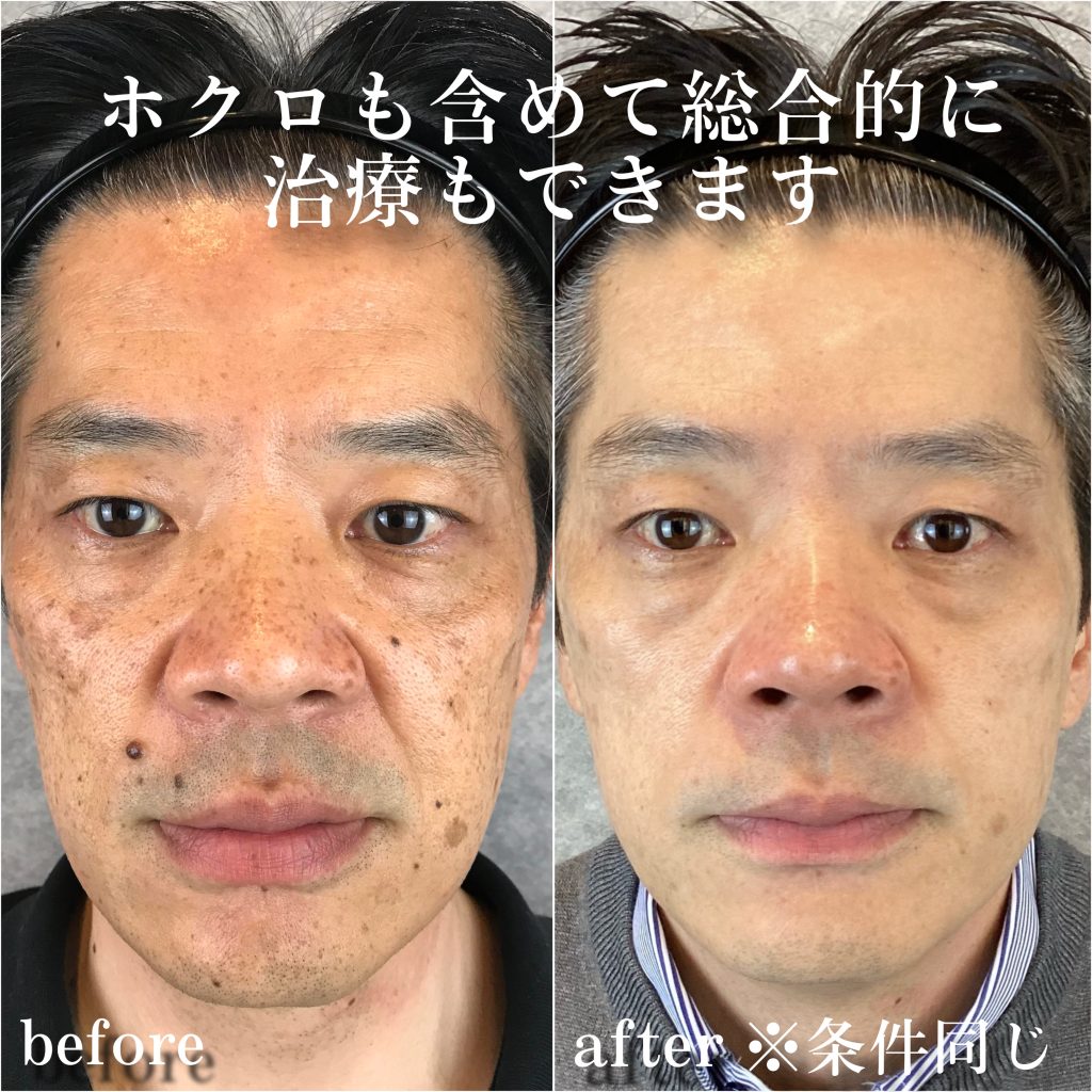 ビフォーアフター