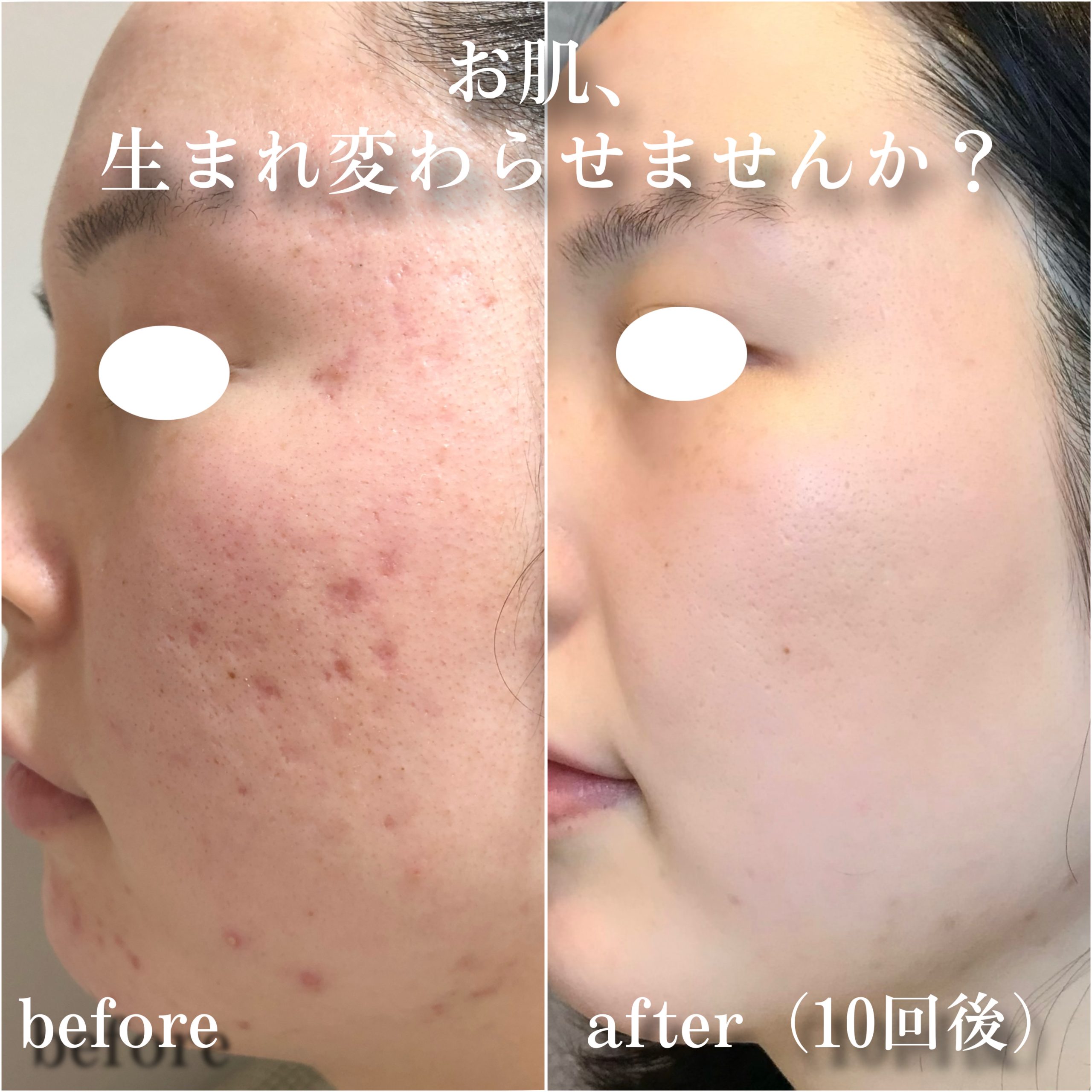 No.12949の症例写真