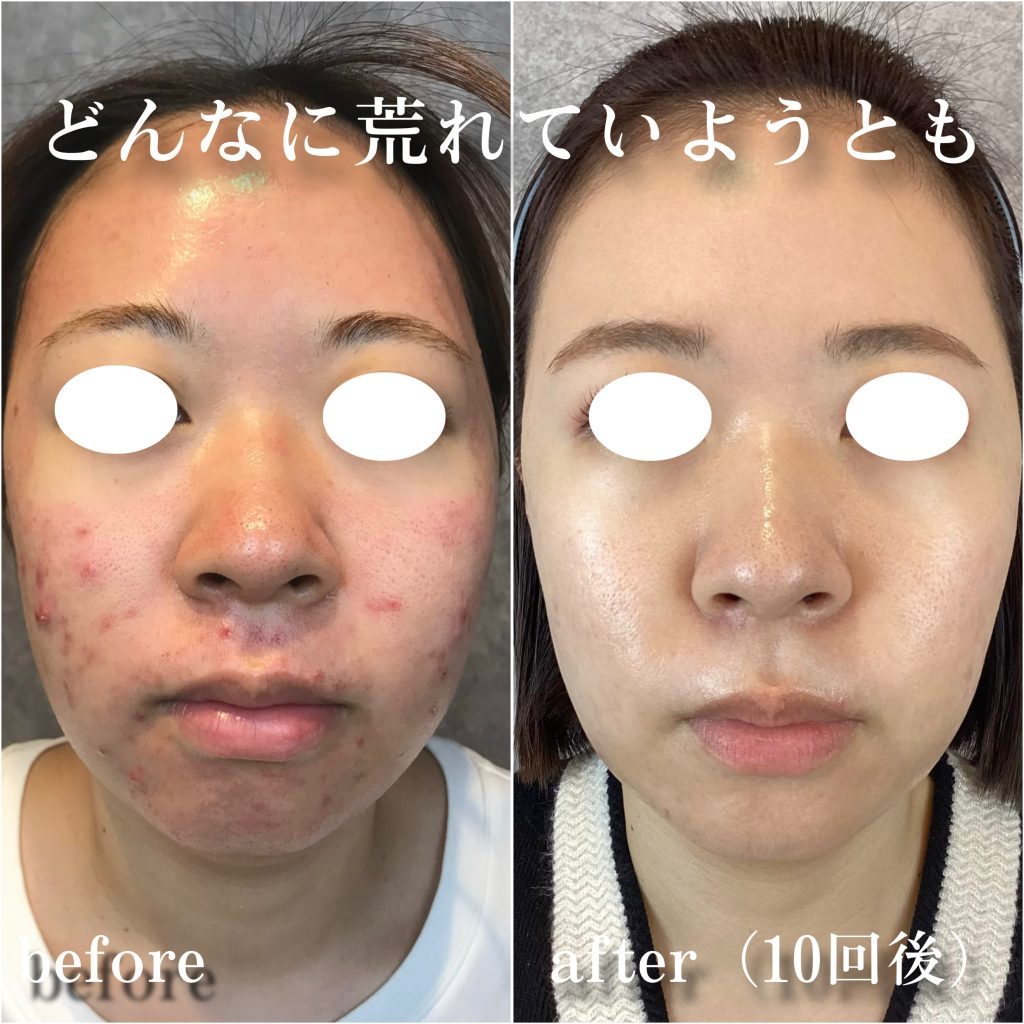 ビフォーアフター