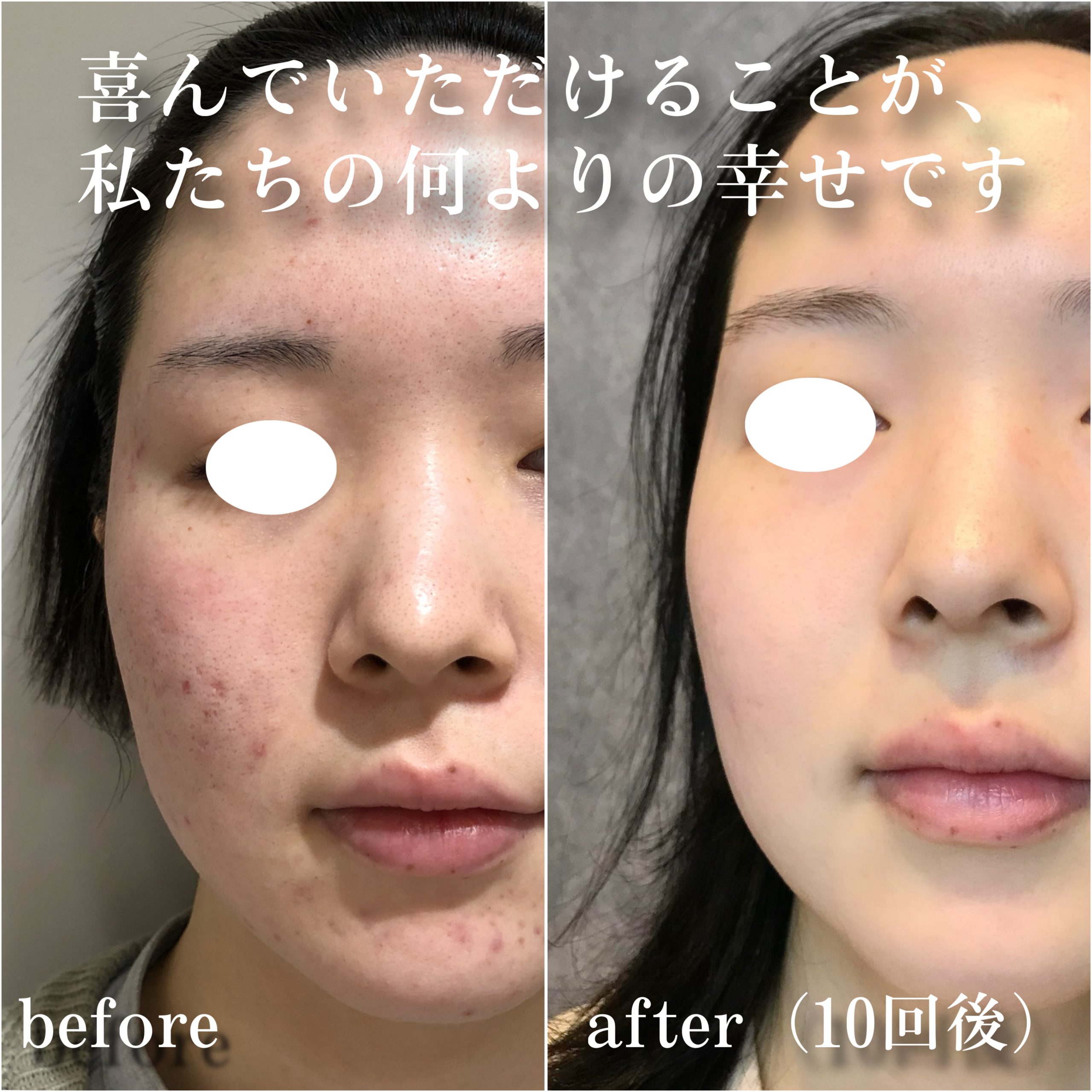 No.12944の症例写真