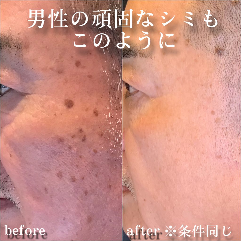 ビフォーアフター