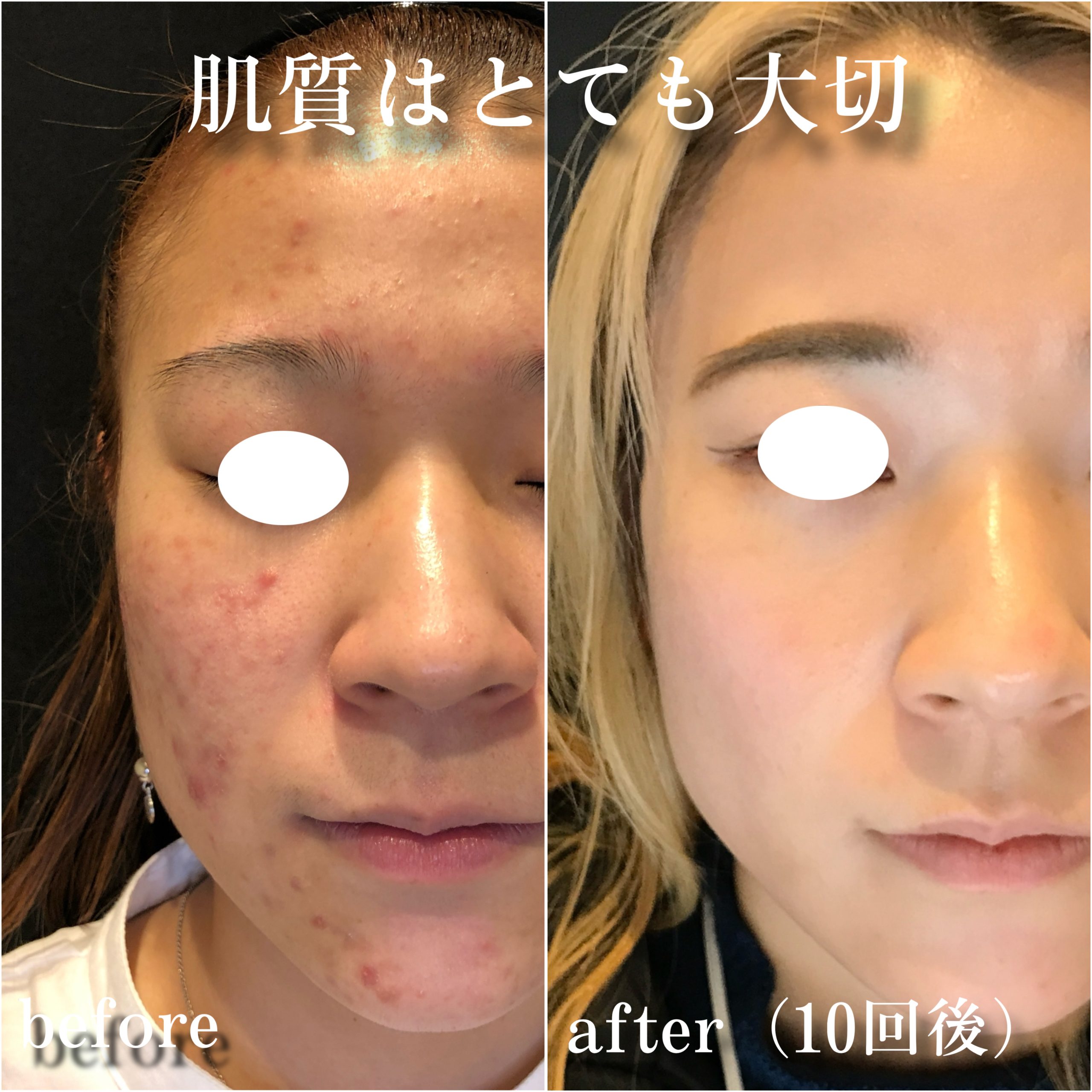 No.13003の症例写真