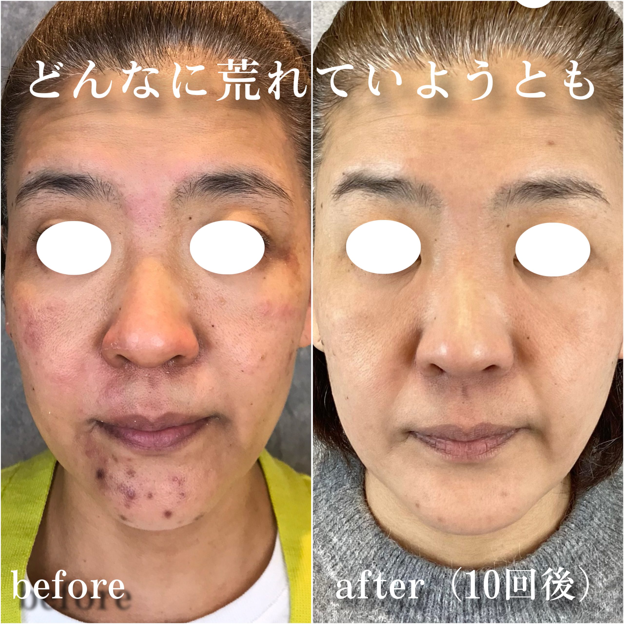 No.12997の症例写真 No.12997の症例写真