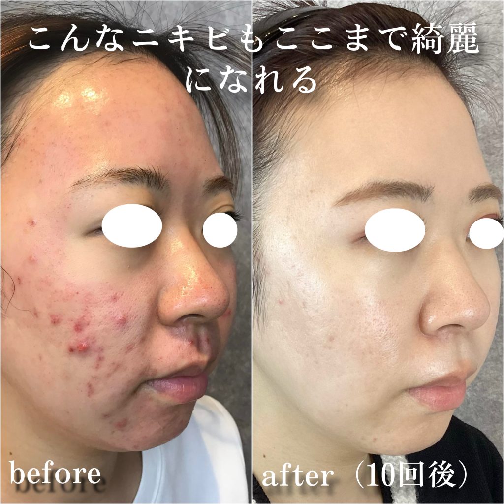 ビフォーアフター