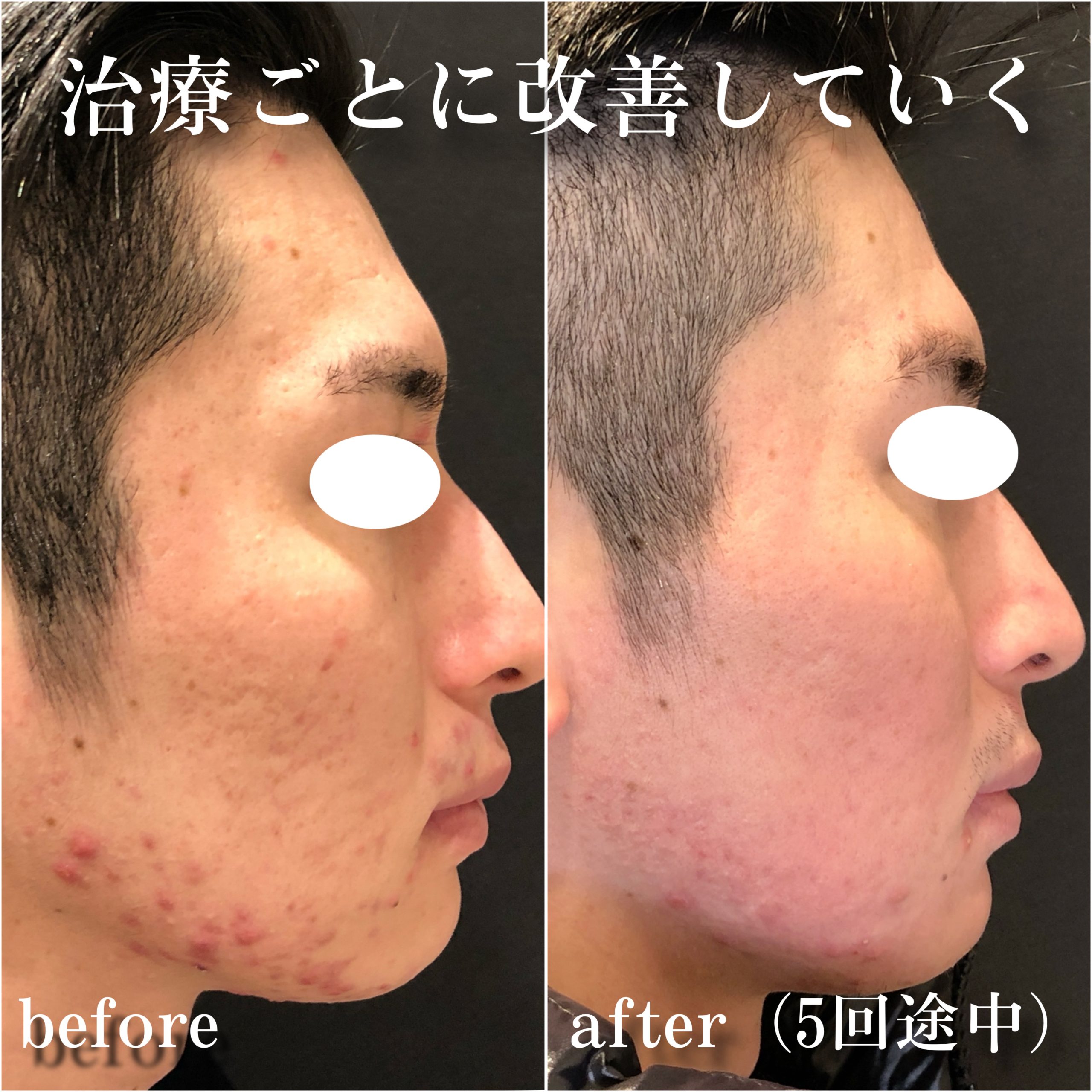 No.12957の症例写真