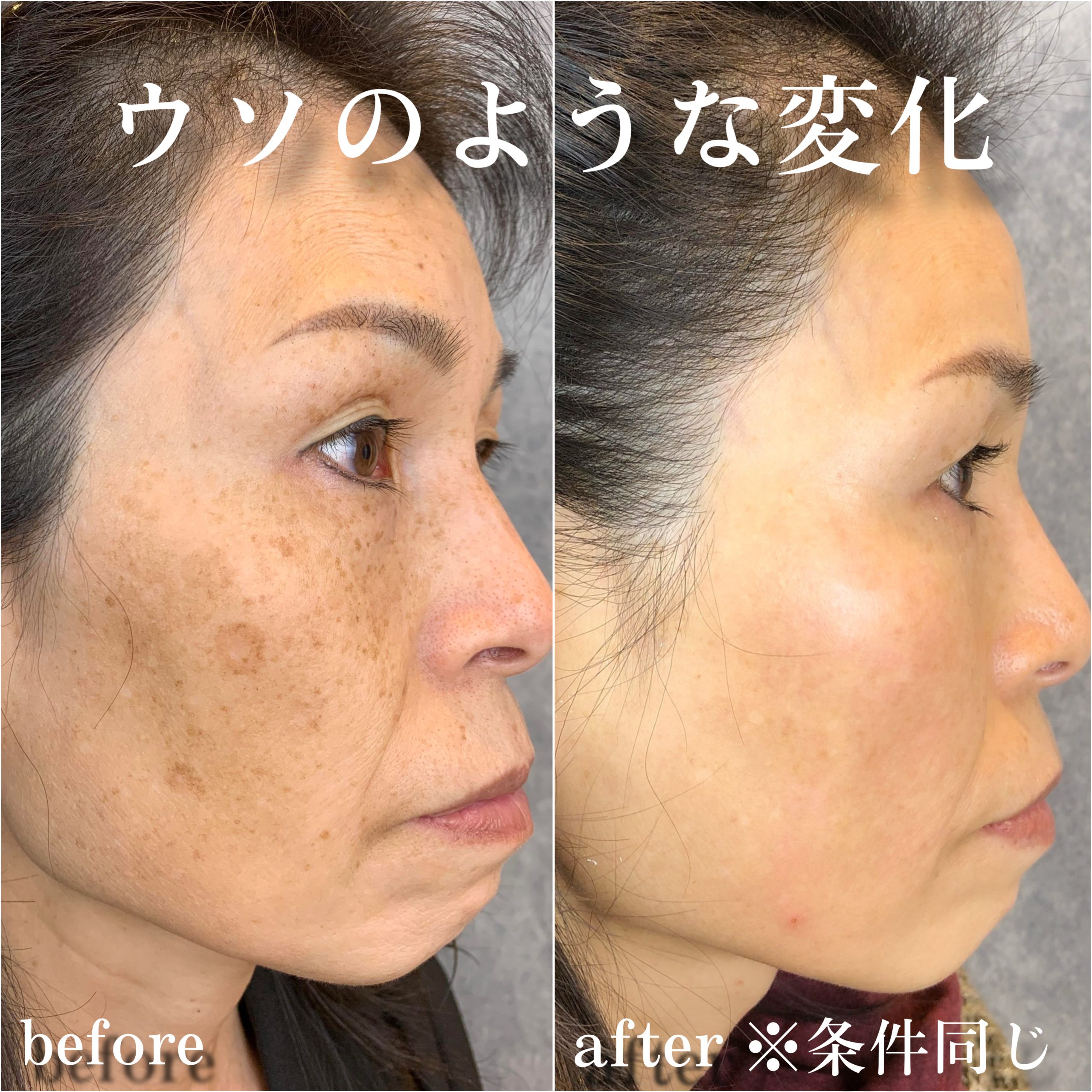 No.12988の症例写真 No.12988の症例写真