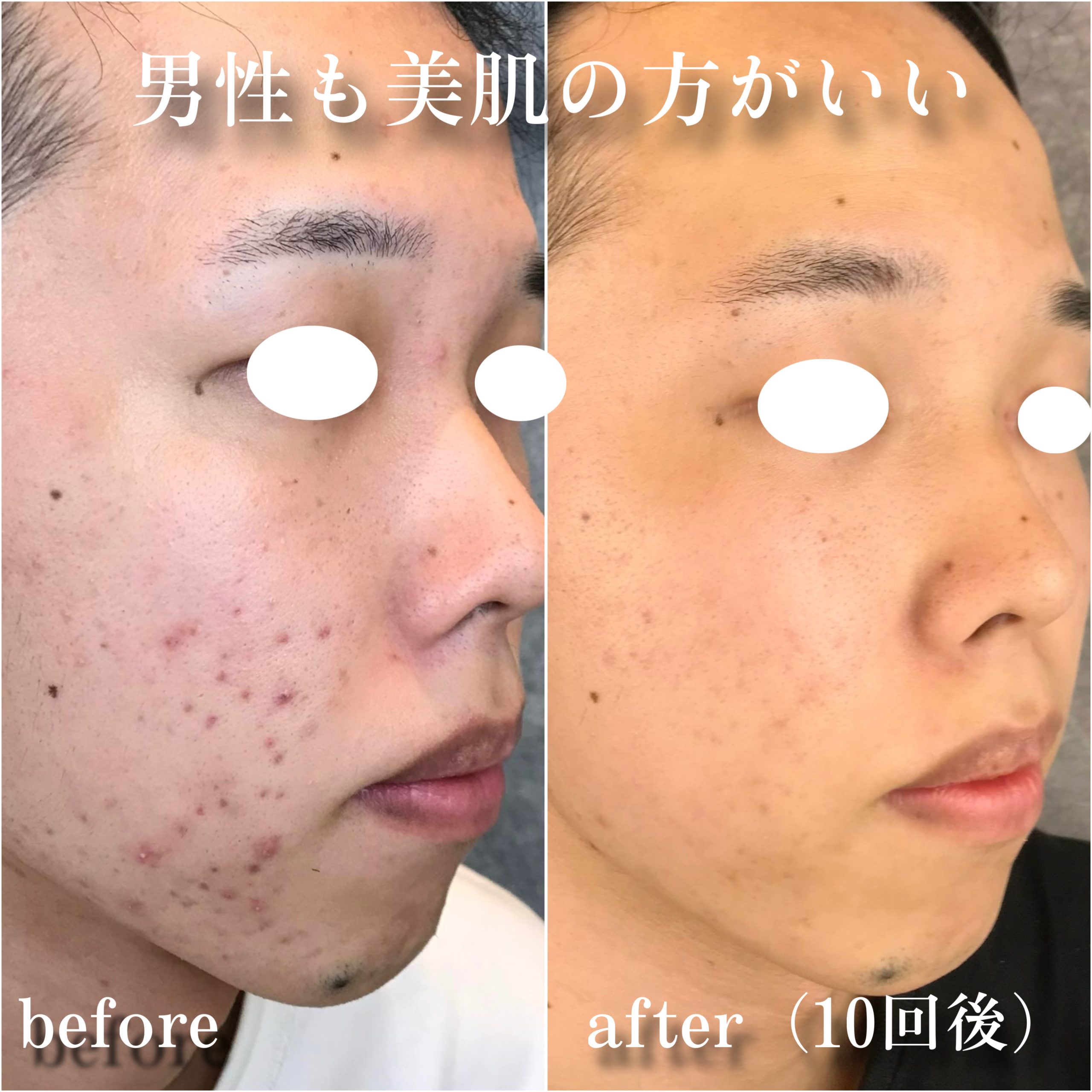 No.12947の症例写真