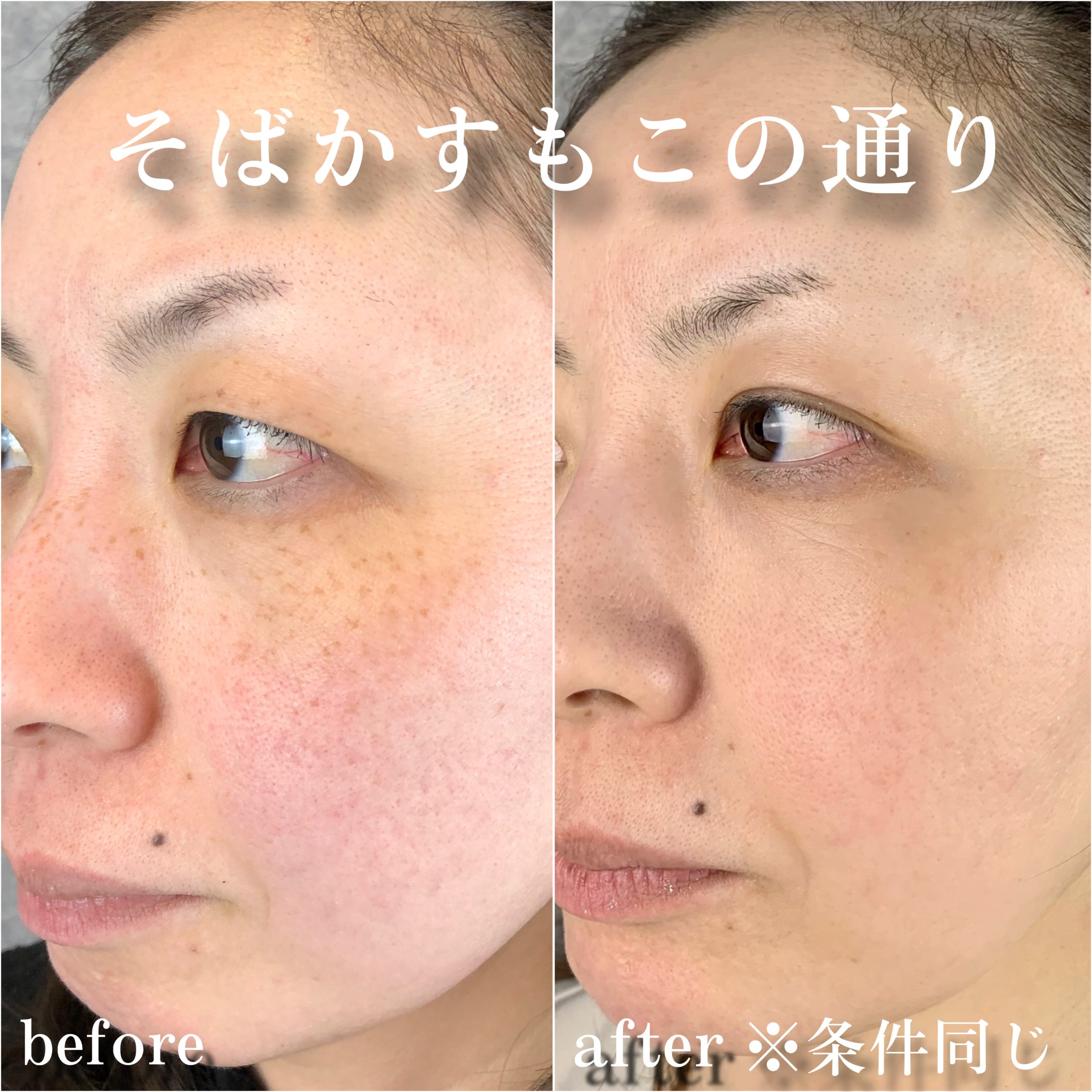 No.12979の症例写真