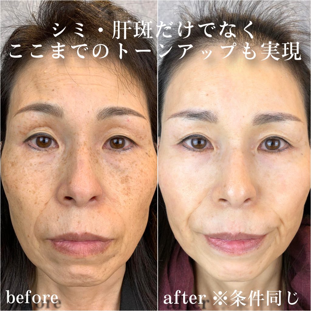 ビフォーアフター