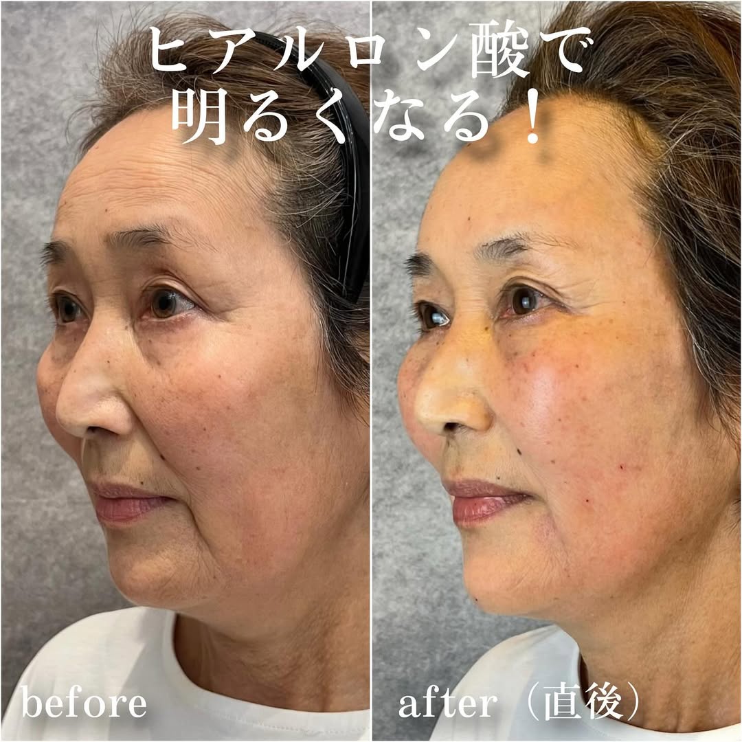 No.13512の症例写真 No.13512の症例写真